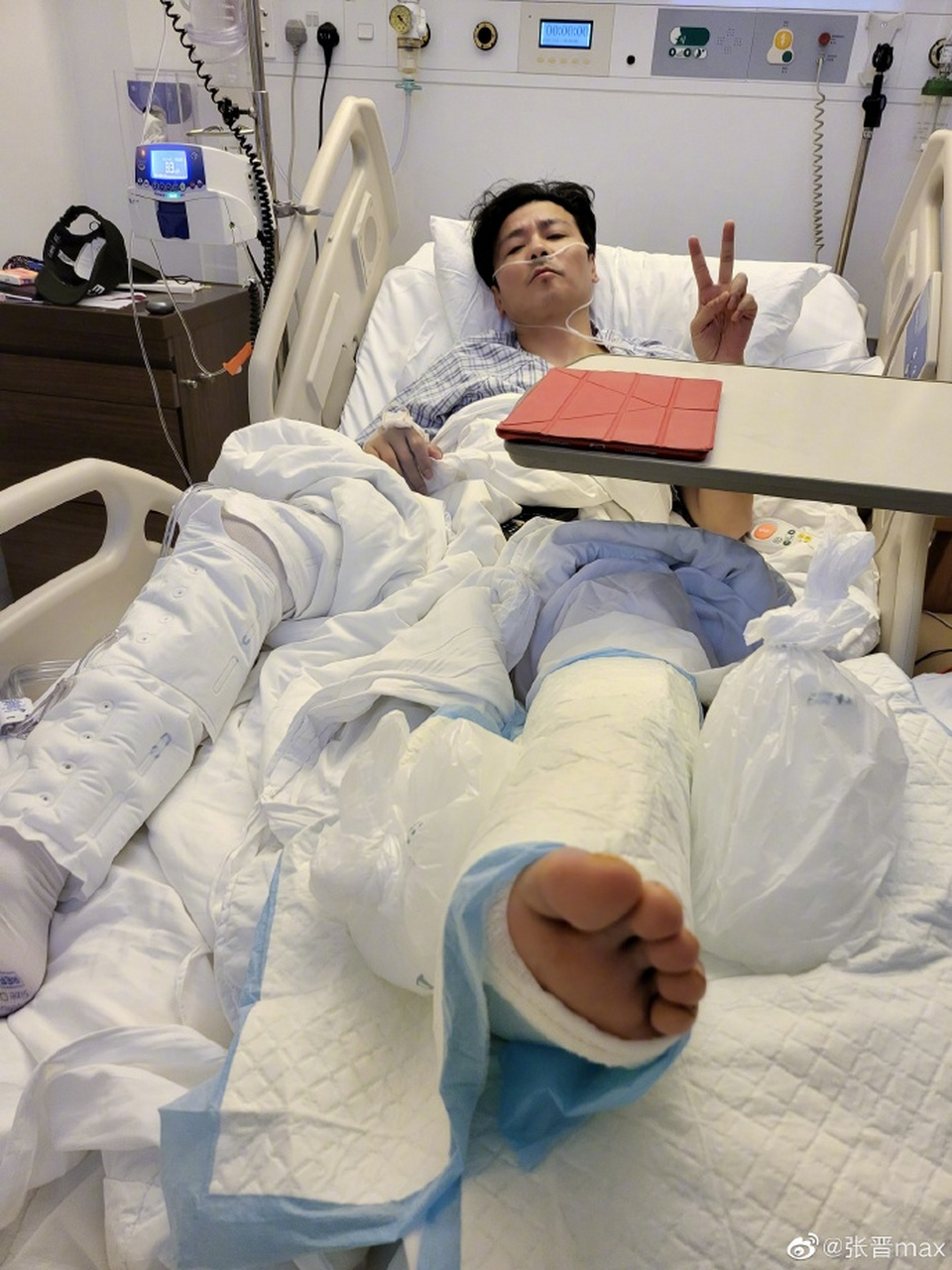 张晋拍戏负伤,单脚打石膏被吊起,网友:娘娘心疼了