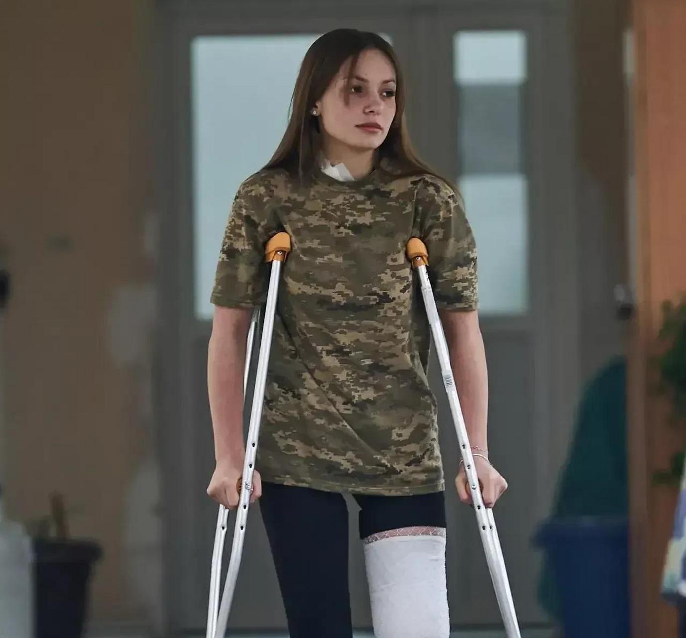 因为俄乌战争,乌克兰美女变成了残疾人.