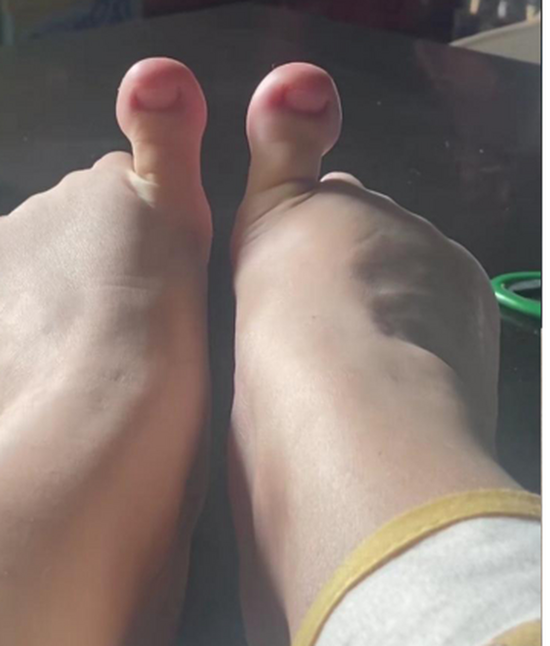 给你们看下我的大脚丫,是不是很丑?