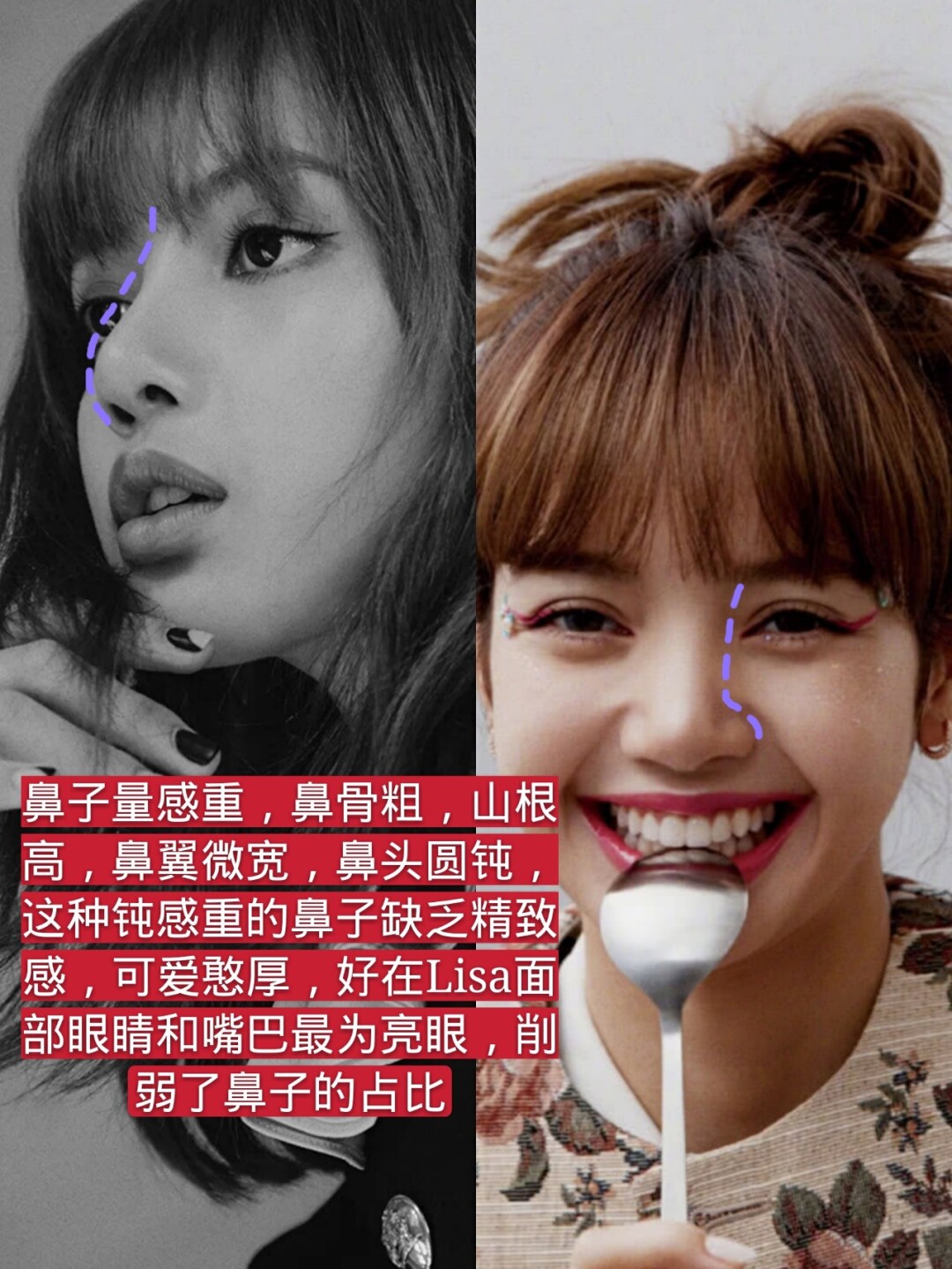 lisa整容鼻子图片