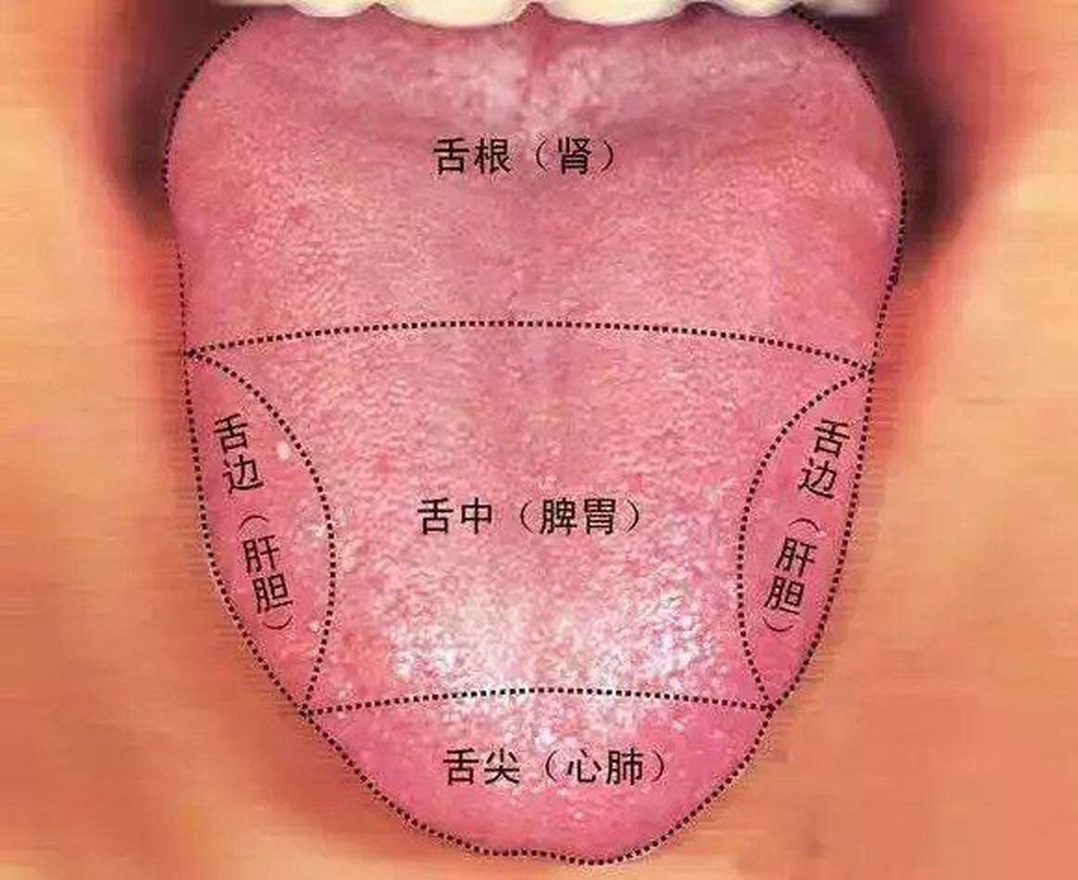 舌头中间有裂纹,代表脾胃虚弱.