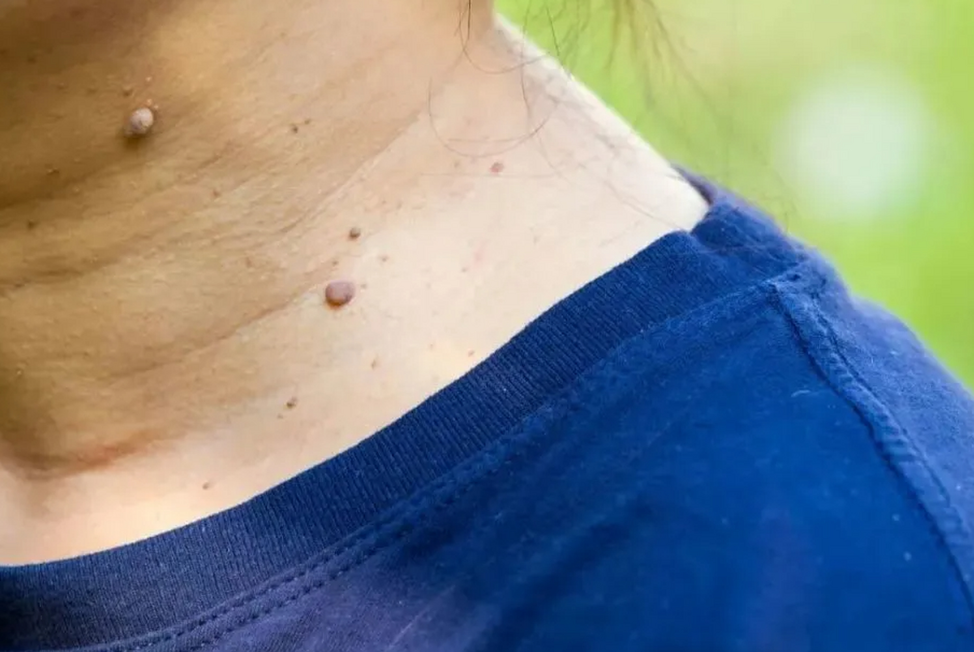 查出hpv阳性该怎么办?