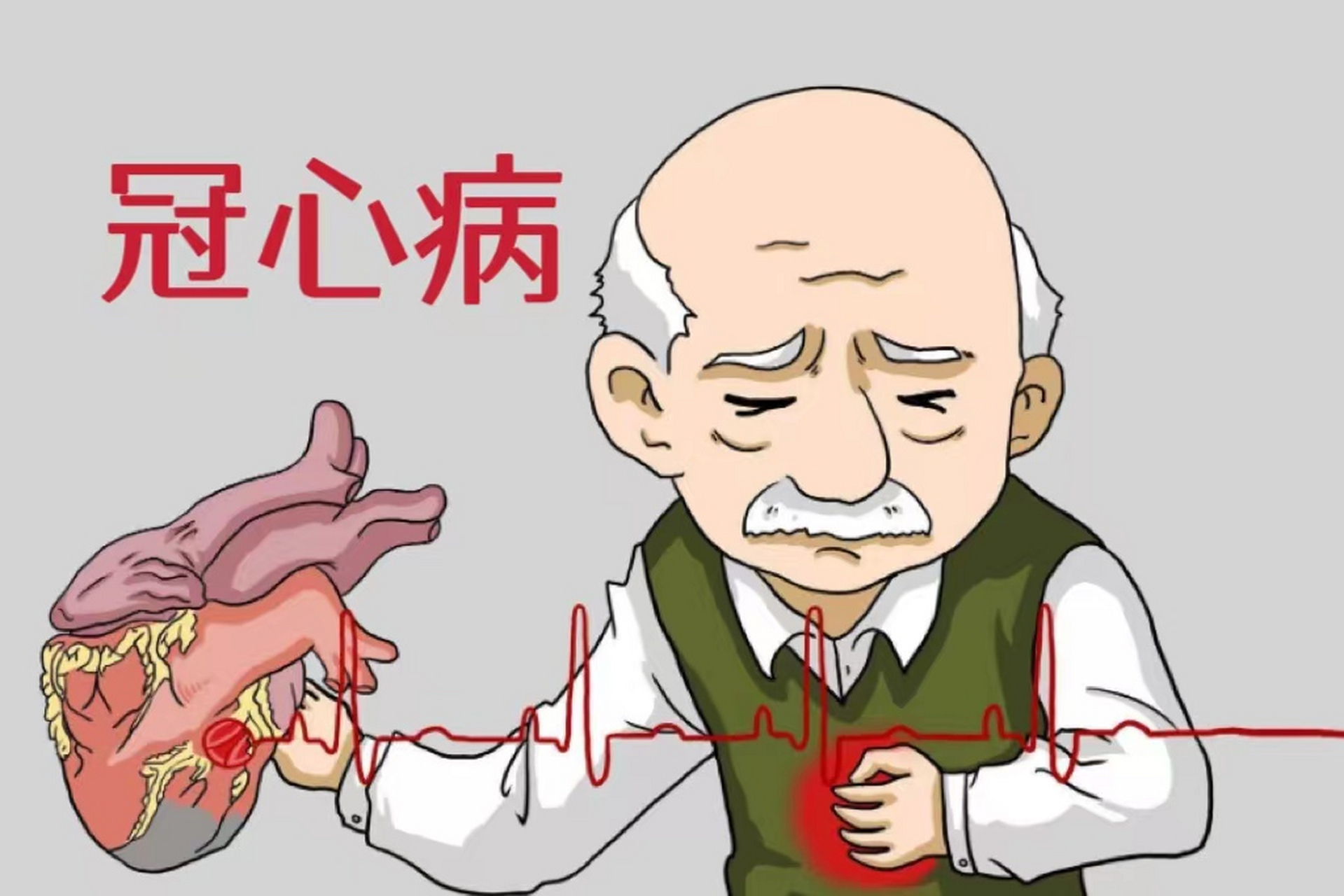 2.高脂,高热量饮食者.不良饮食习惯增高血脂,容易导致冠心病.