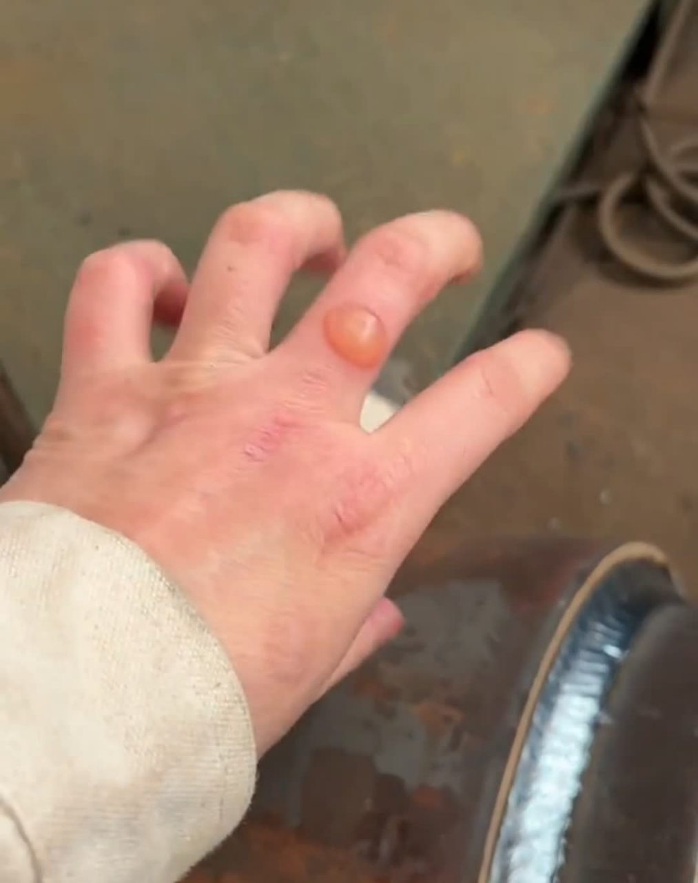 我一天只挣500块钱,手指都被烫伤了. 生活太艰难了.[笑哭]