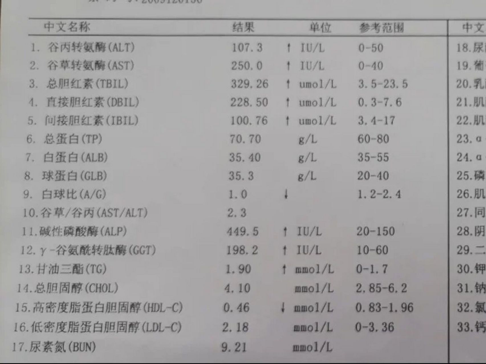 肝功能檢查單這4點一定要注意啊!