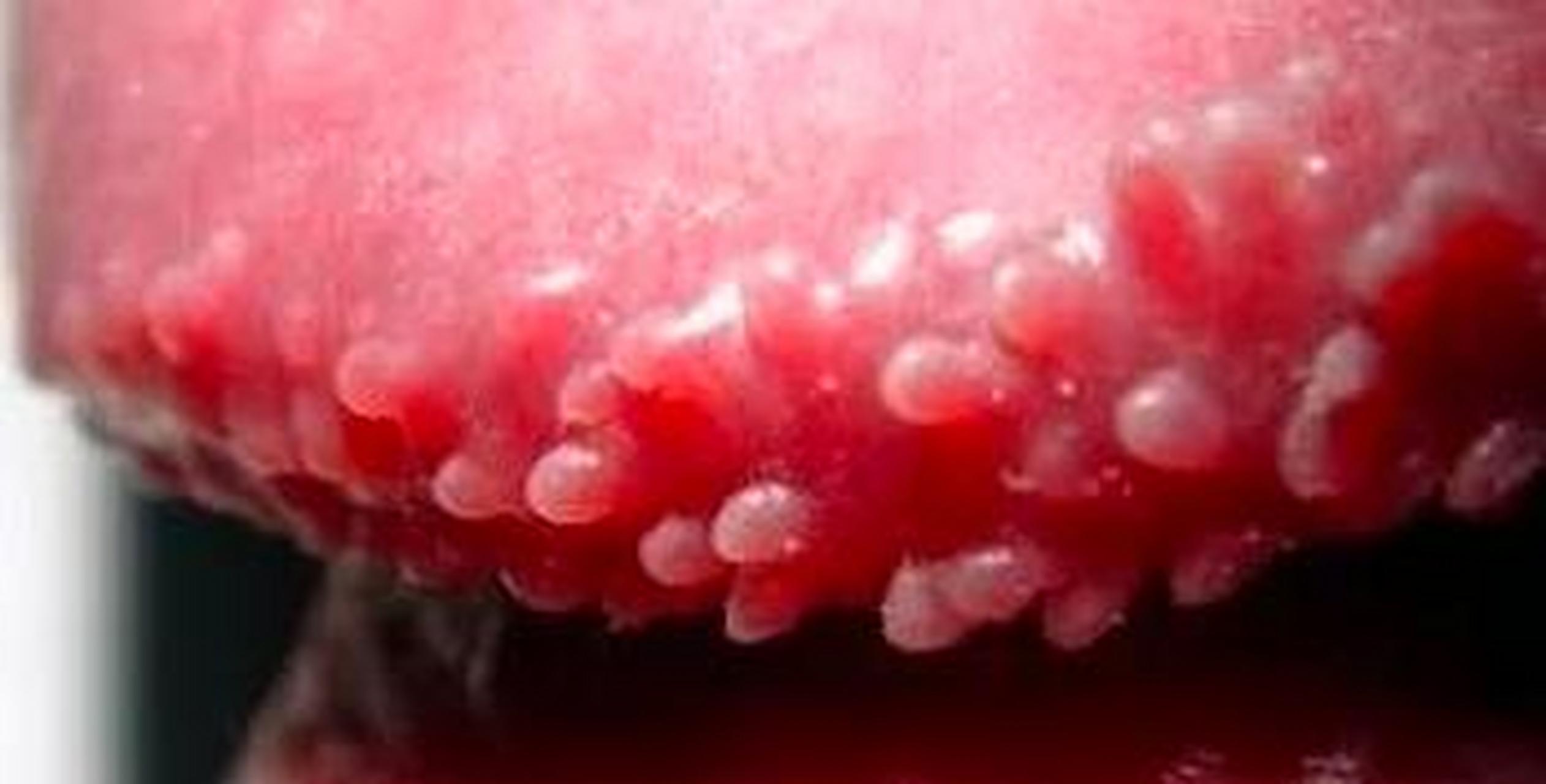 丁丁上的小疙瘩,不都说是"#疣# "吗?