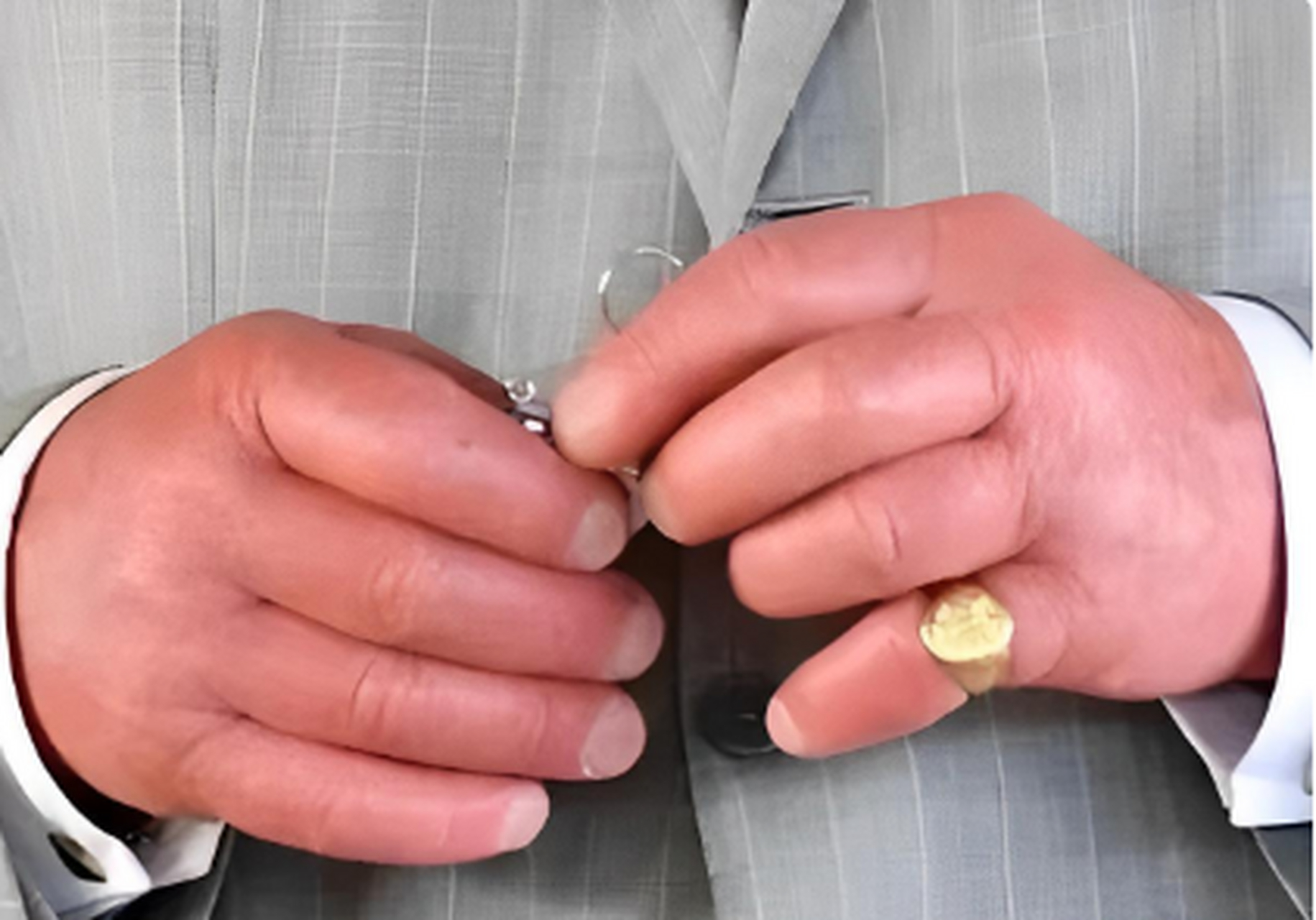 这个男人身材高大偏瘦,但却有一双胖胖的手,仿佛水肿了一般.