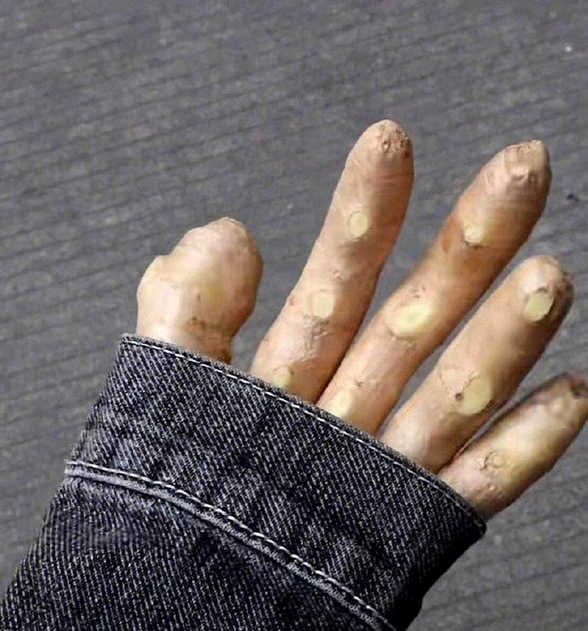 我的手冻得像姜一样.
