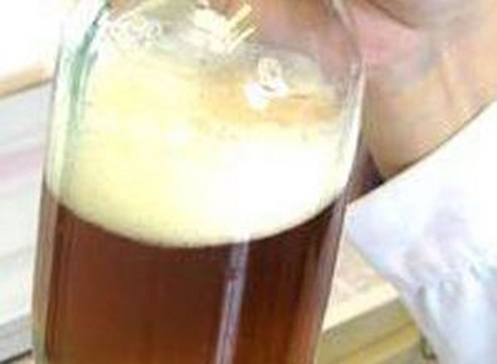 21岁的晓蕾是一名大三学生,去年6月不明诱因出现肉眼血尿2次,无发热及