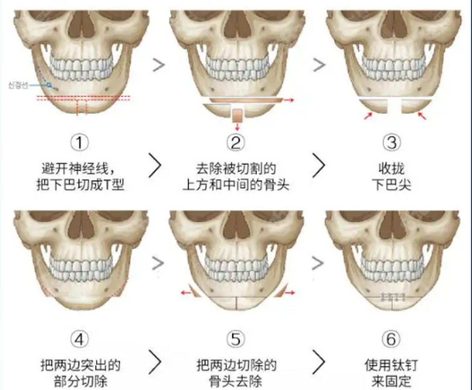 颏左前位图片