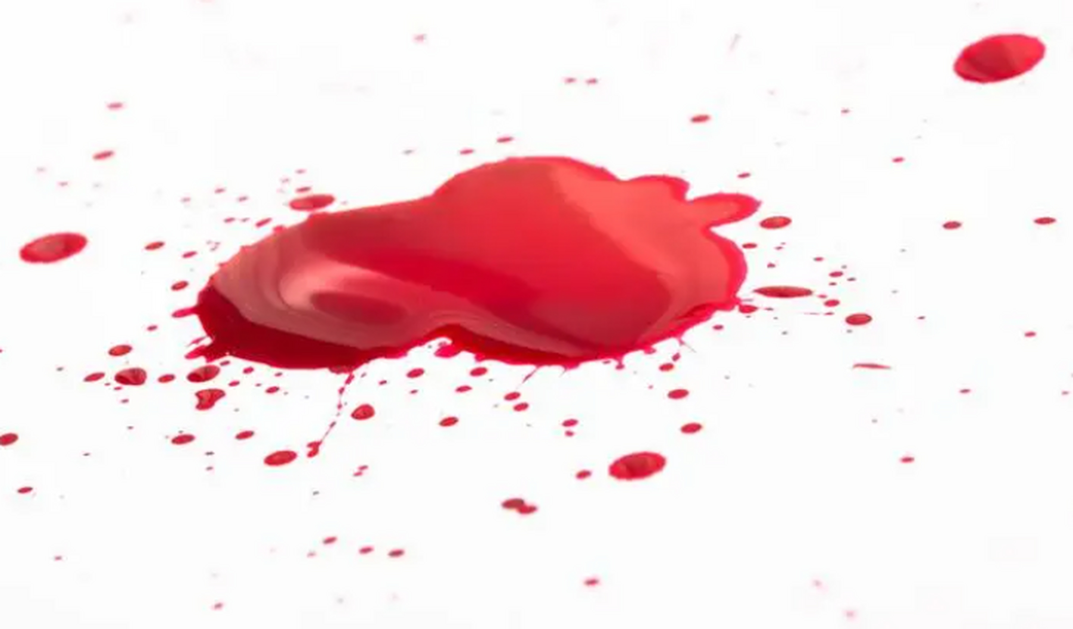 我上完厕所突然涌出一滩鲜红的血,吓坏了!