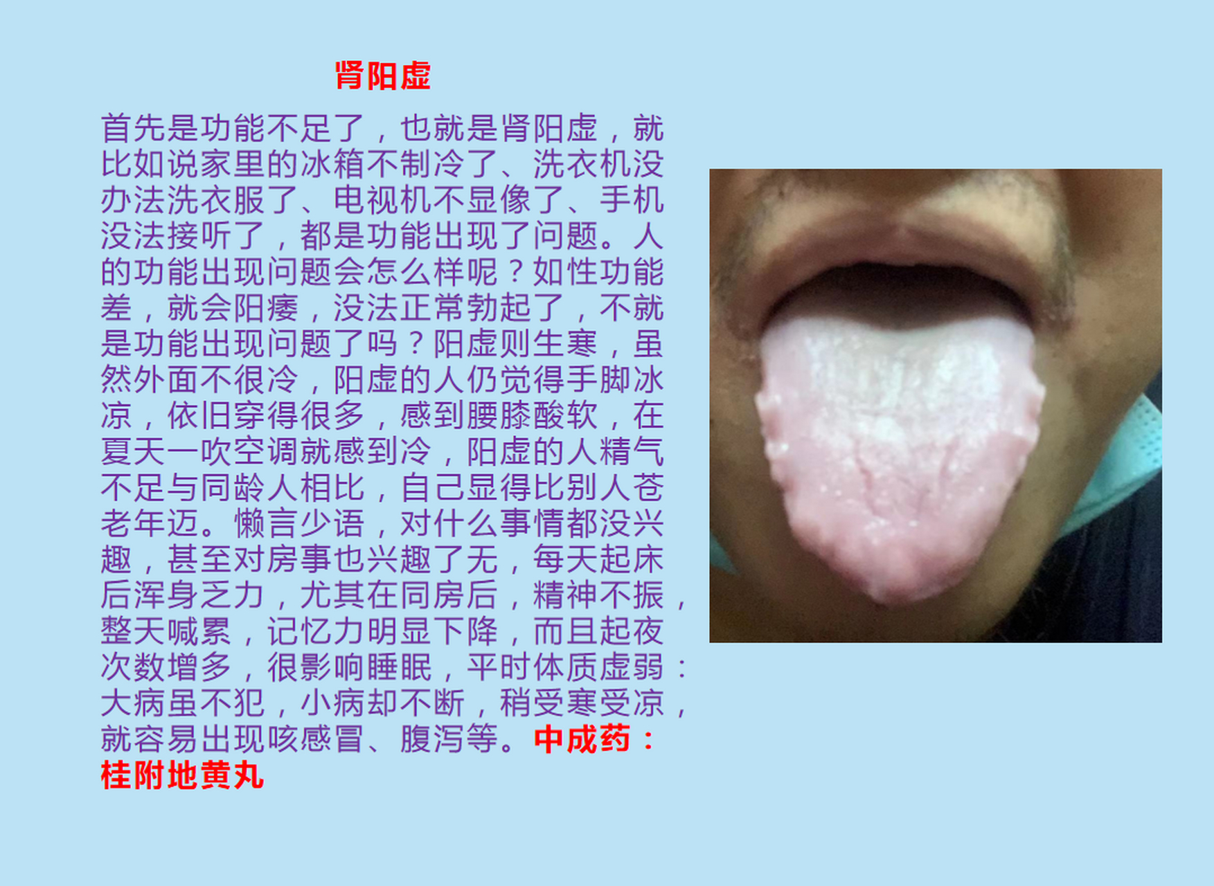 肾阴阳两虚(肾阴阳两虚如何调理)