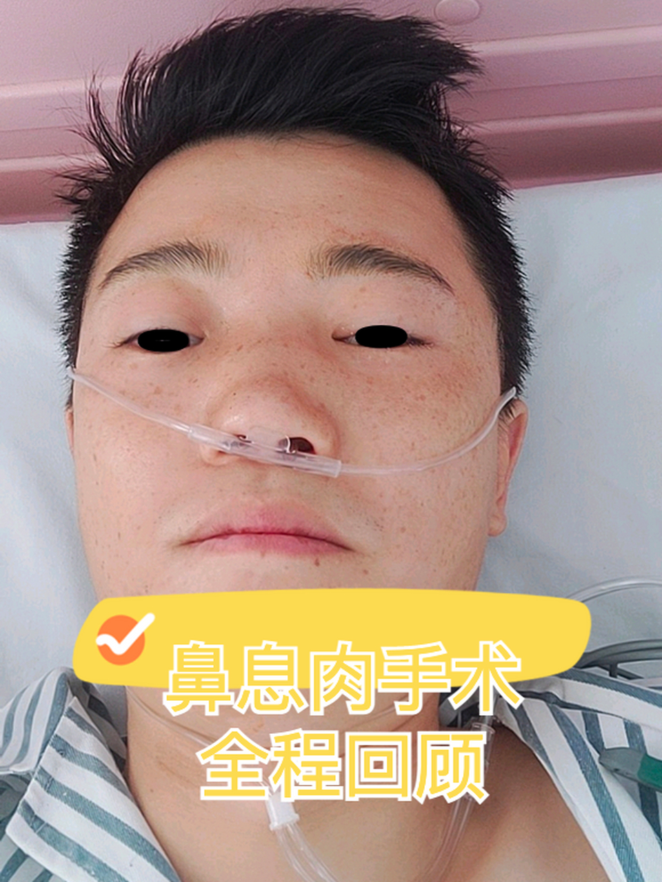 鼻息肉手术全程回顾——  2014.