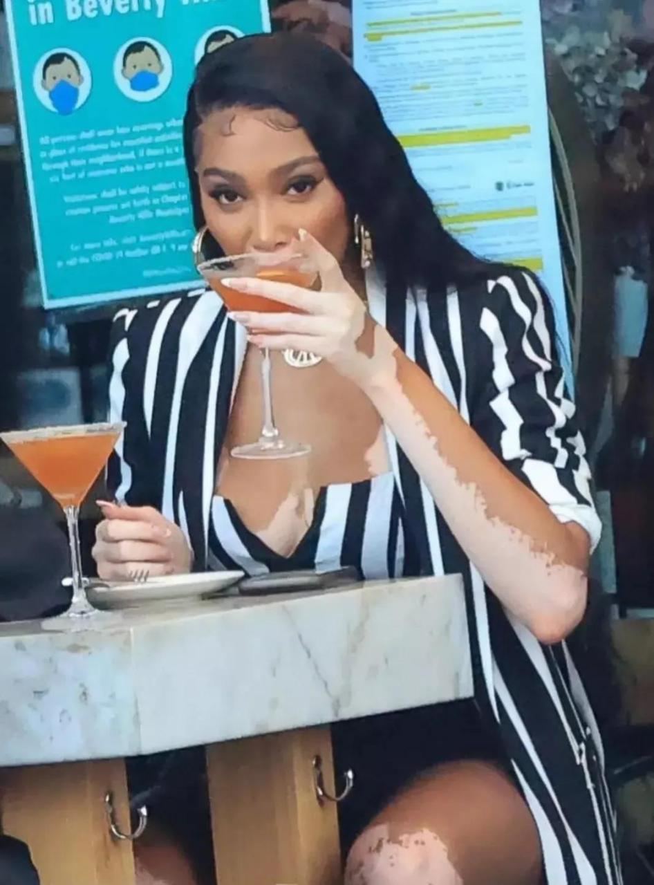 哈洛穿黑白条纹风衣,搭配黑色高跟长筒靴,大秀超模修长美腿. 温妮.