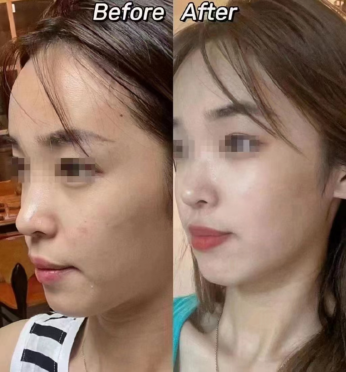 面部整体看起来饱满了很多 幼态感满满,越来越