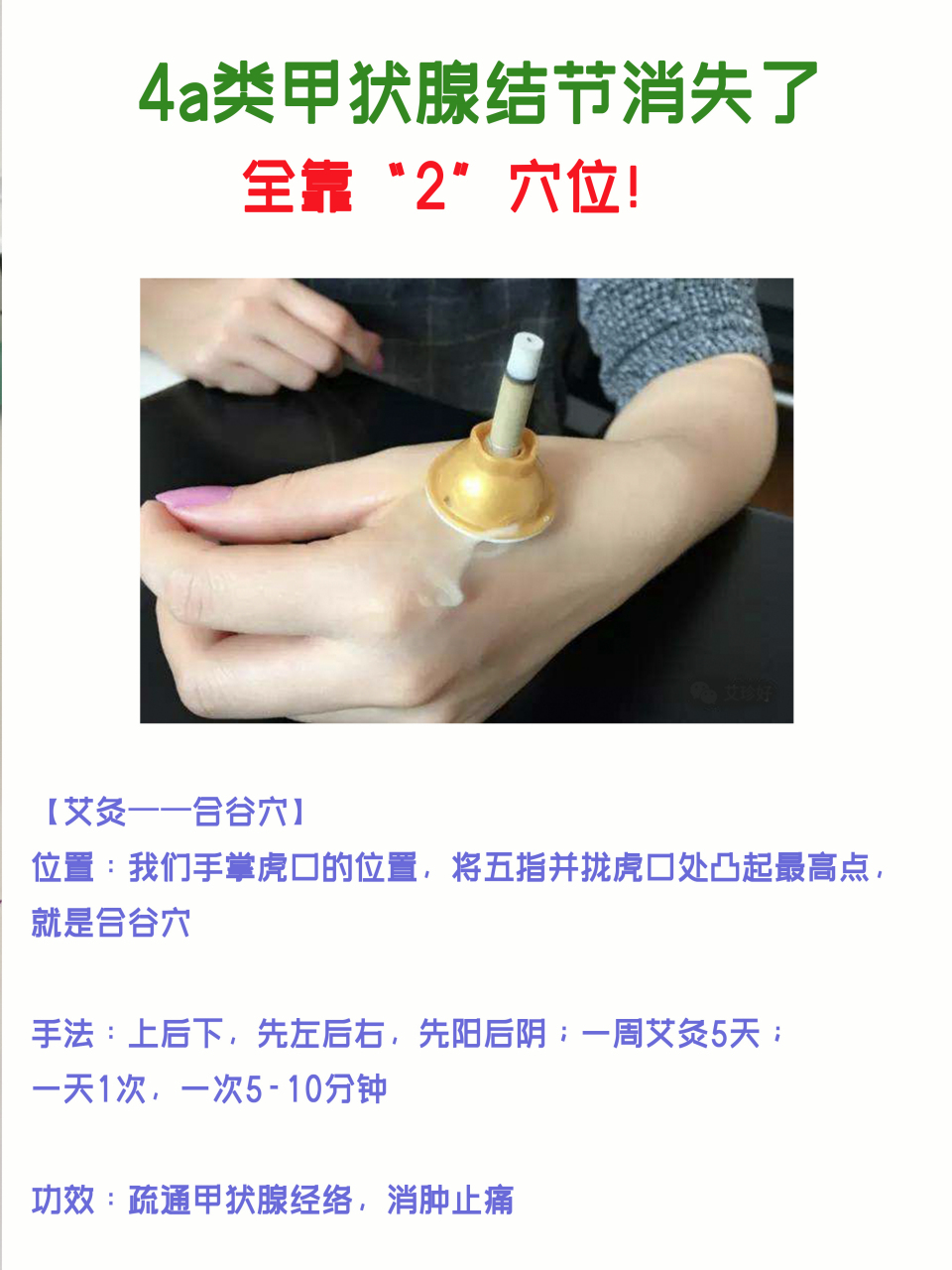 甲状腺结节艾灸图图片