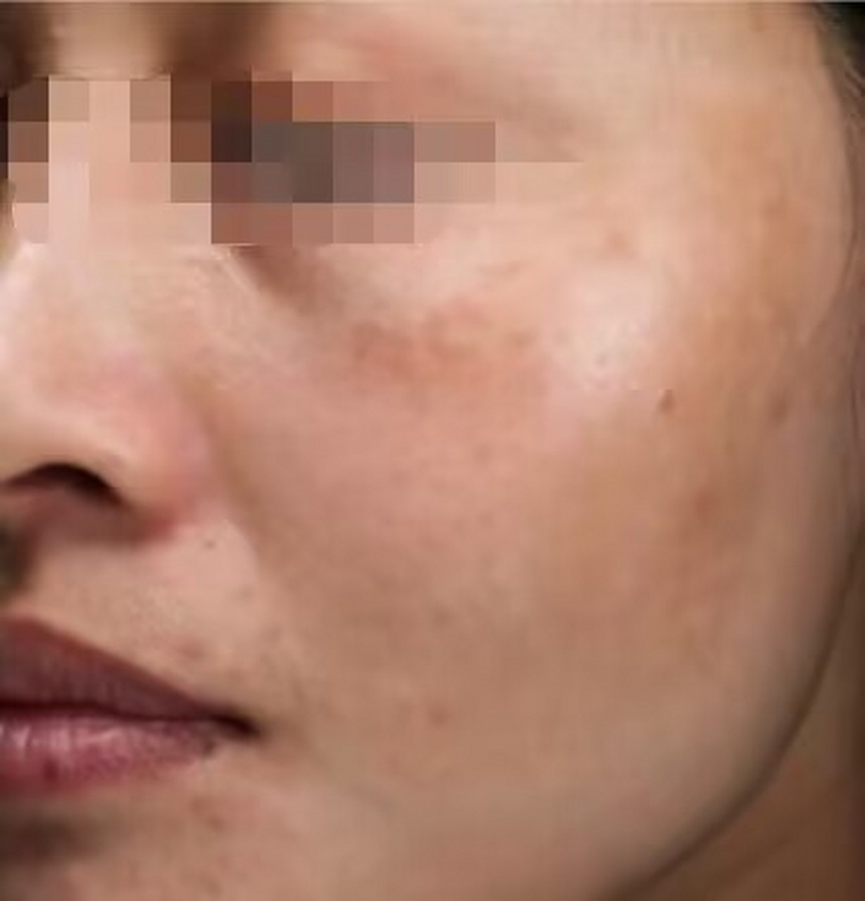 黄脸婆是形容一个人的面色比较黄,苍白,没有气色,很多人可能经常会