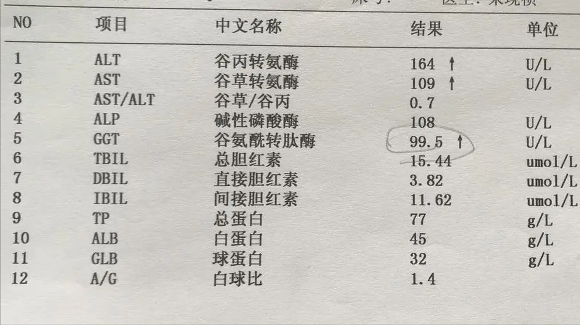 肝功能13项详细解读,不会看报告的看这里 1.