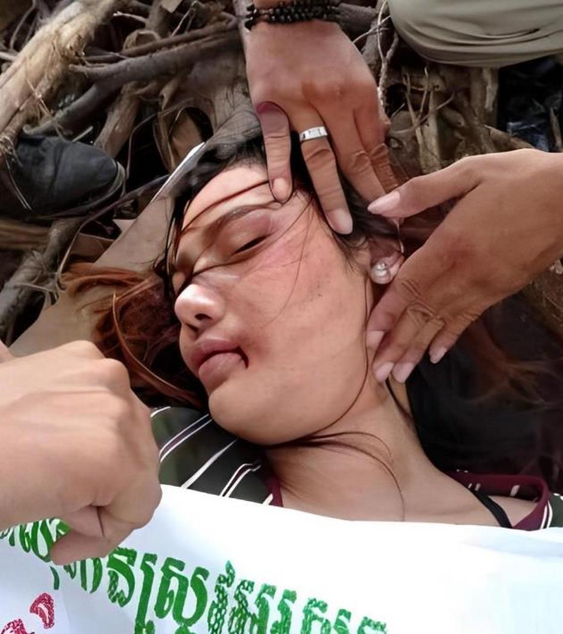 3月2日下午,一名浑身是伤的女子跑到柬埔寨西港警局报案,称自己被人