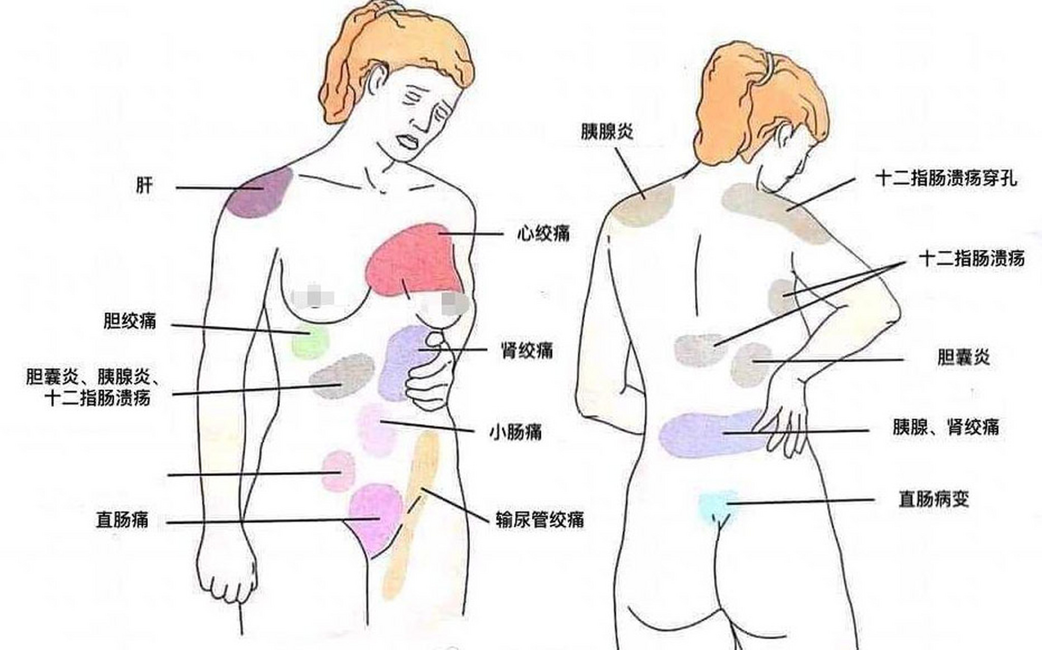 身体各个部位"疼痛"与提示 本图是日常较为常见的疼痛部位对应图