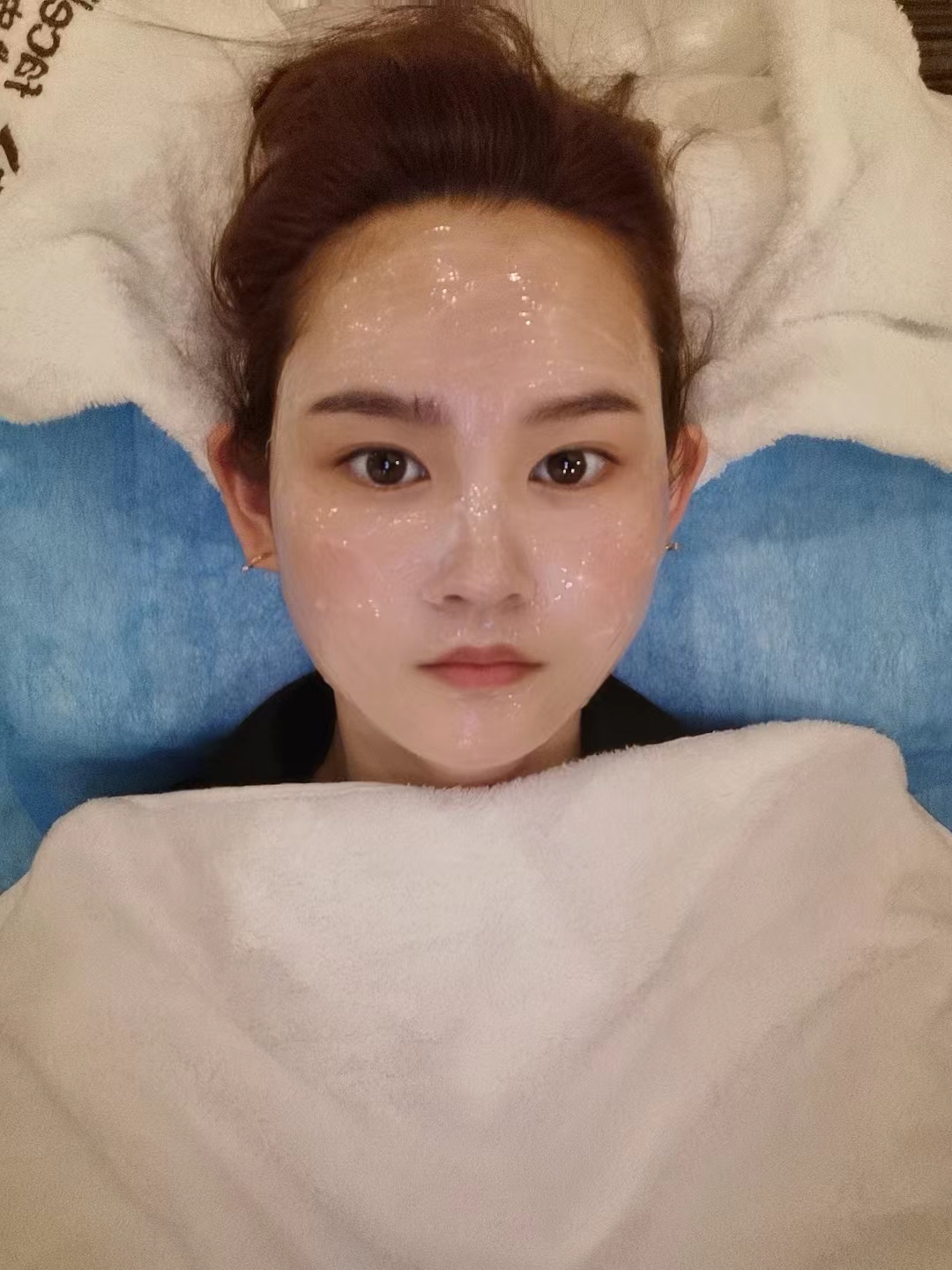 做水光 最近出游玩回来之后发现脸上的晒斑更明显啦肤色也有些暗沉