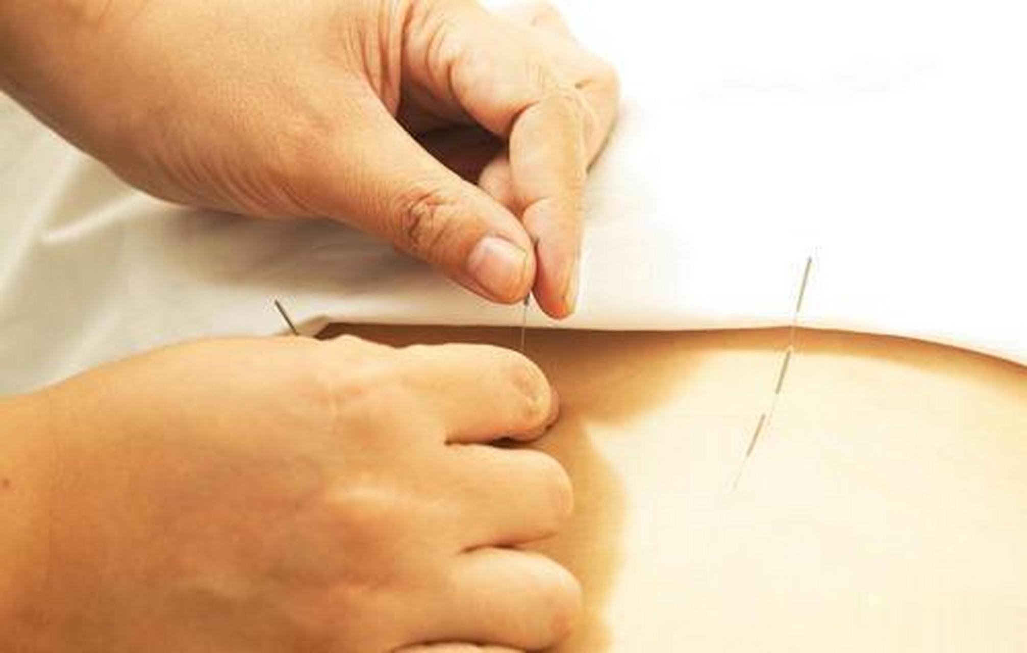 中医针灸知识;针灸歌诀:"古针法歌决":先说平针法,含针口内温,按揉令