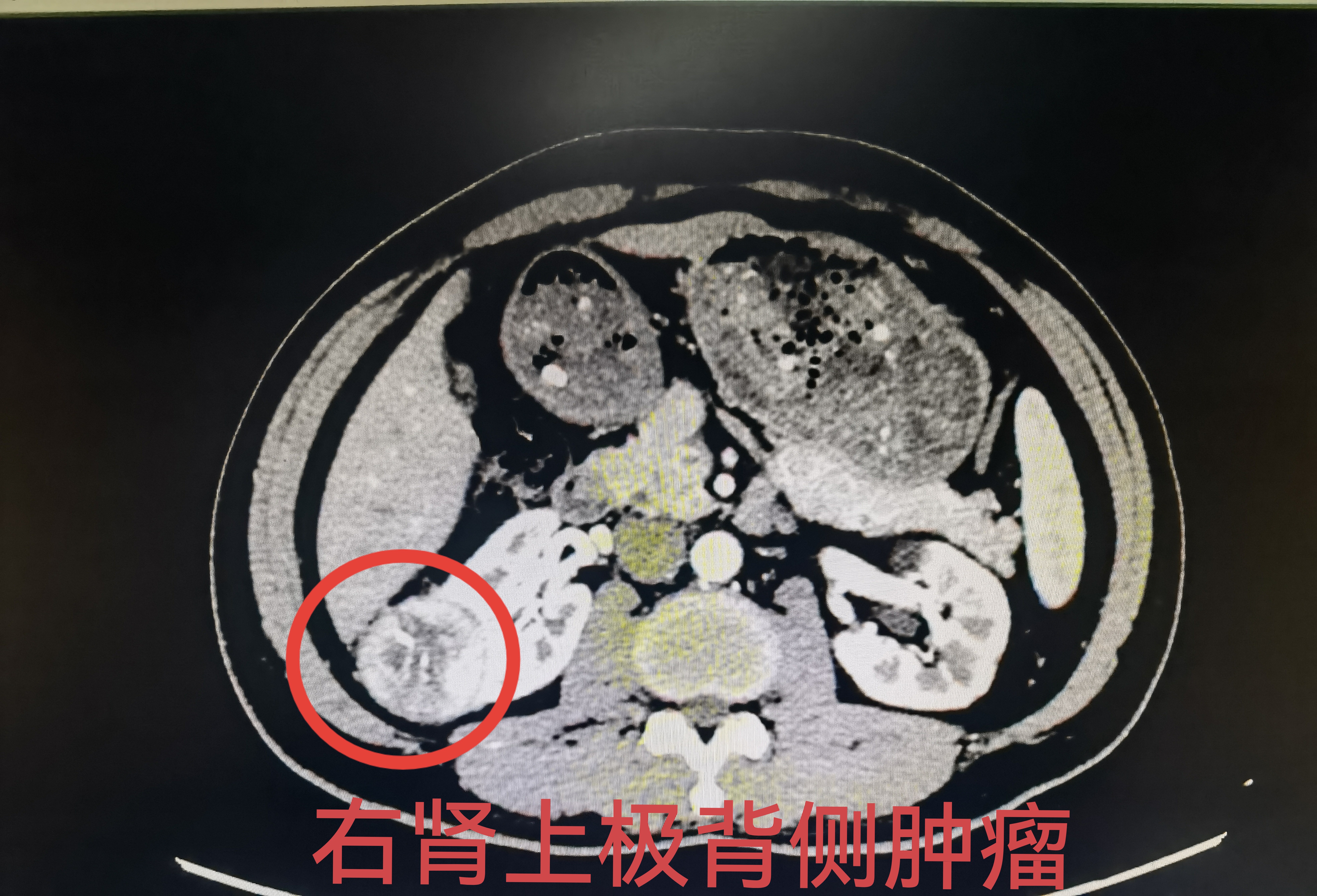  多旋翼有幾個(gè)自由度_多旋翼組成