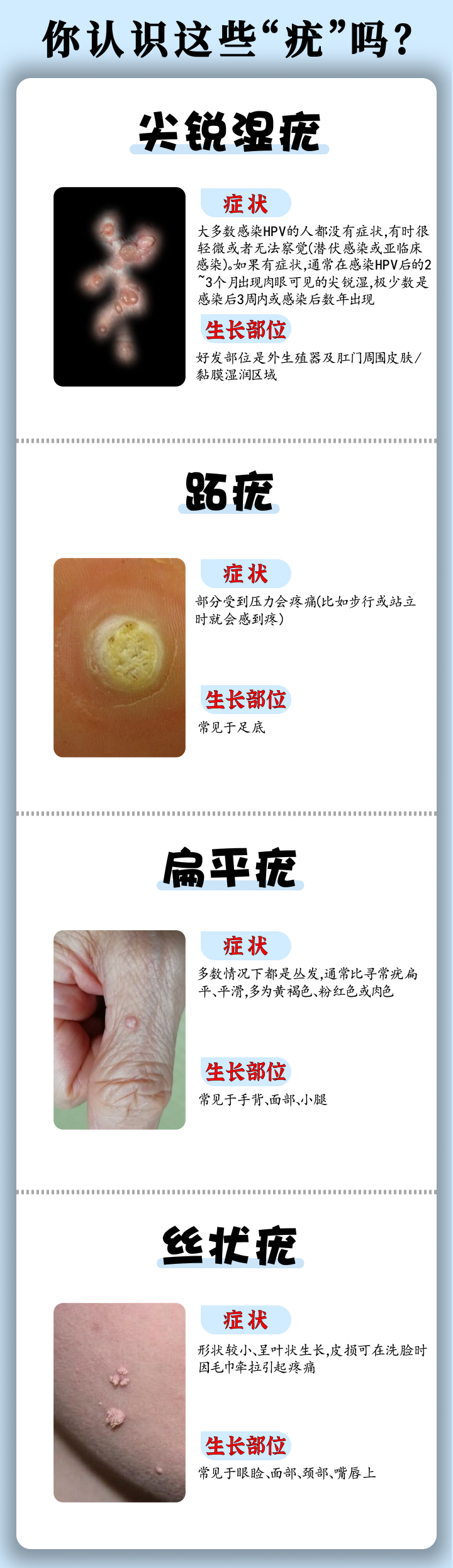 hpv皮肤症状图片