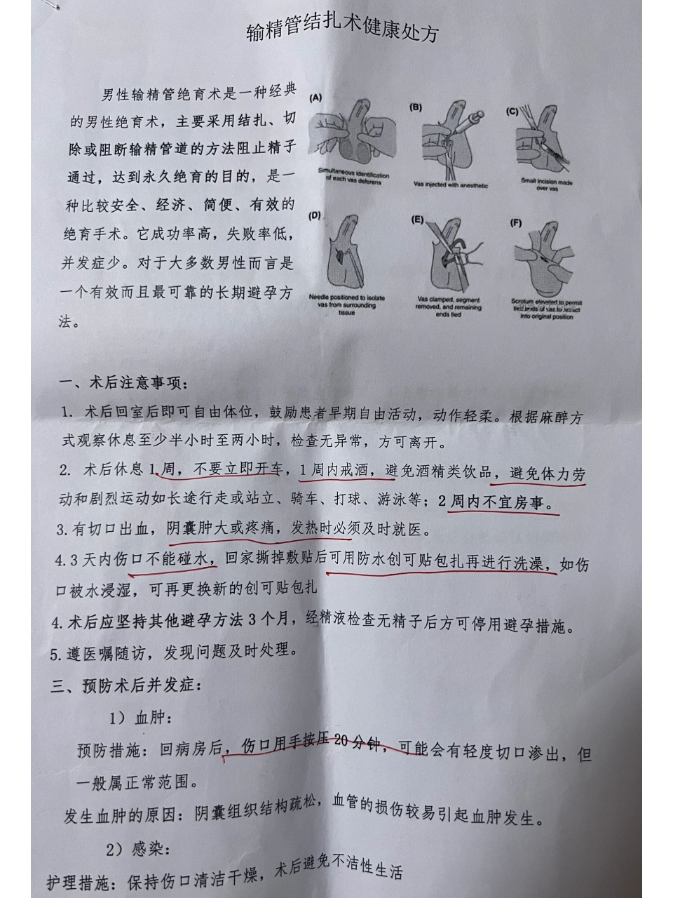 老公结扎后续费用以及术后感受