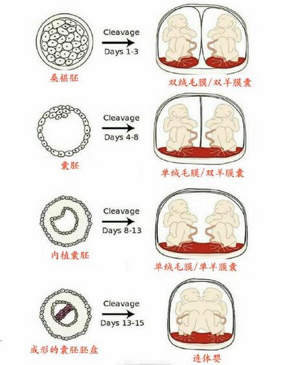 双胞胎有的双羊膜囊,有的单羊膜囊,有的单绒毛膜,有的双绒毛膜.