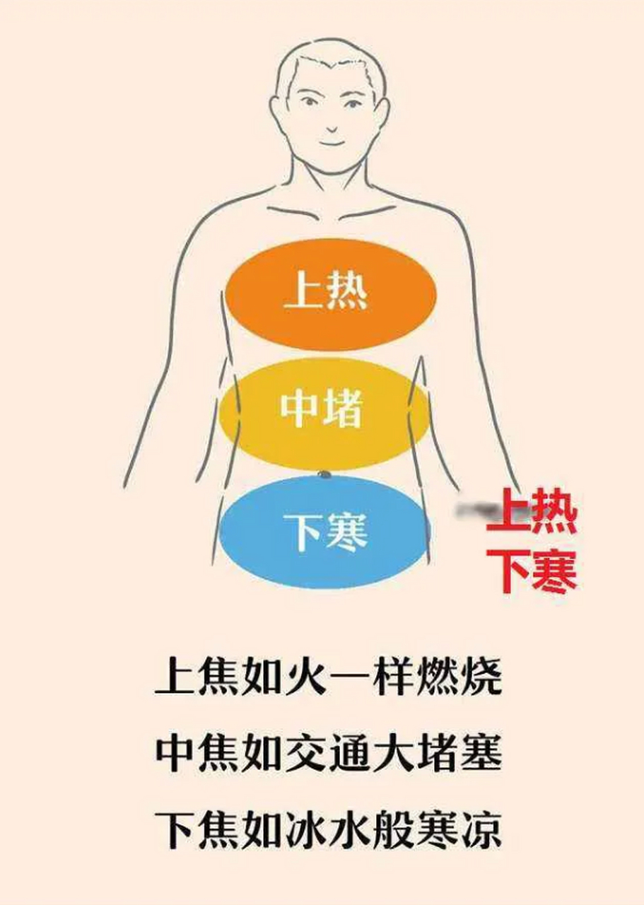 中医说我"上热下寒"?怎样可以引火归元?  很多人得了重病或久病后,出