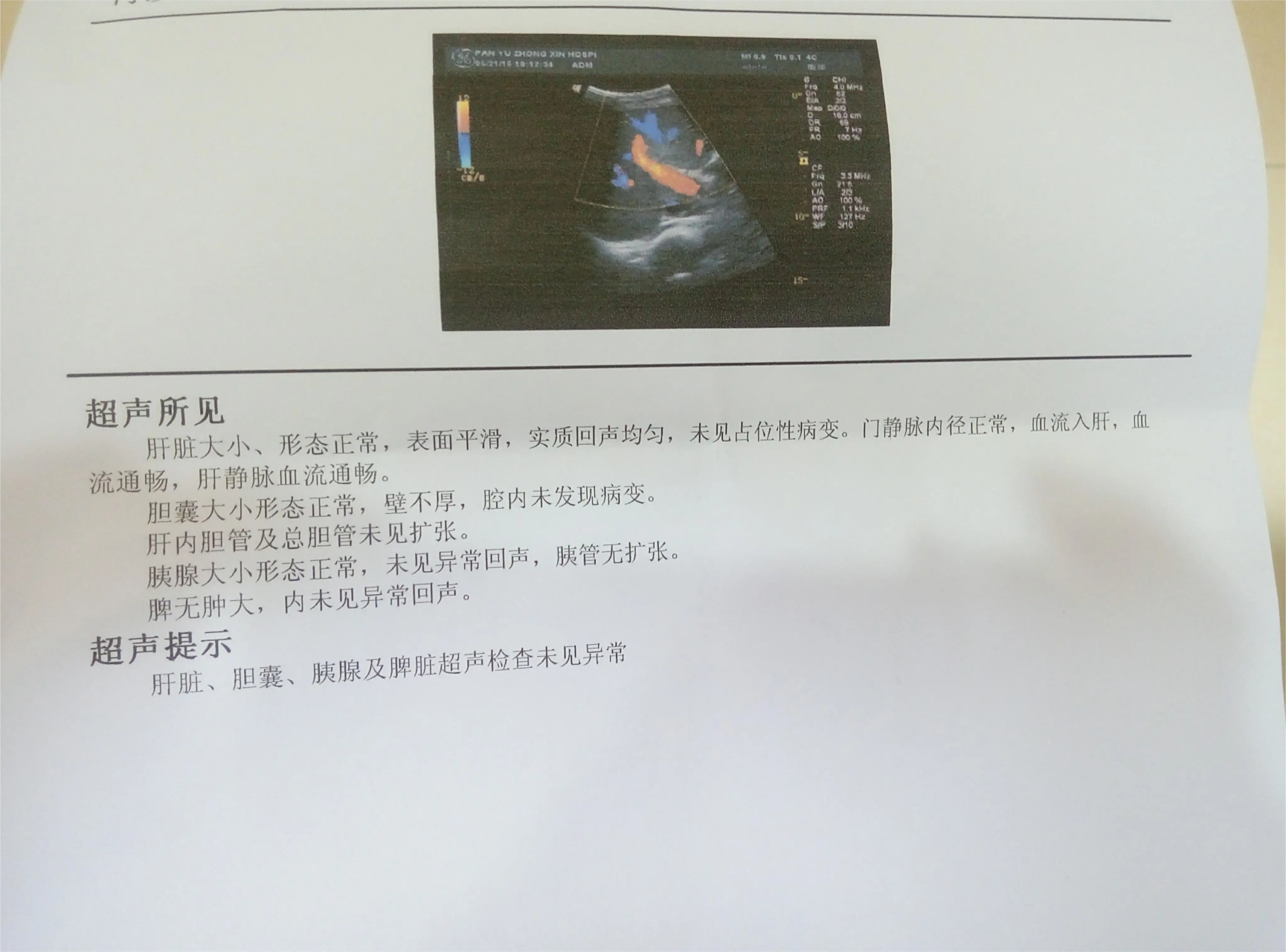 正常的肝脏检查报告,你知道是什么样的吗? 一,肝脏彩超 1.