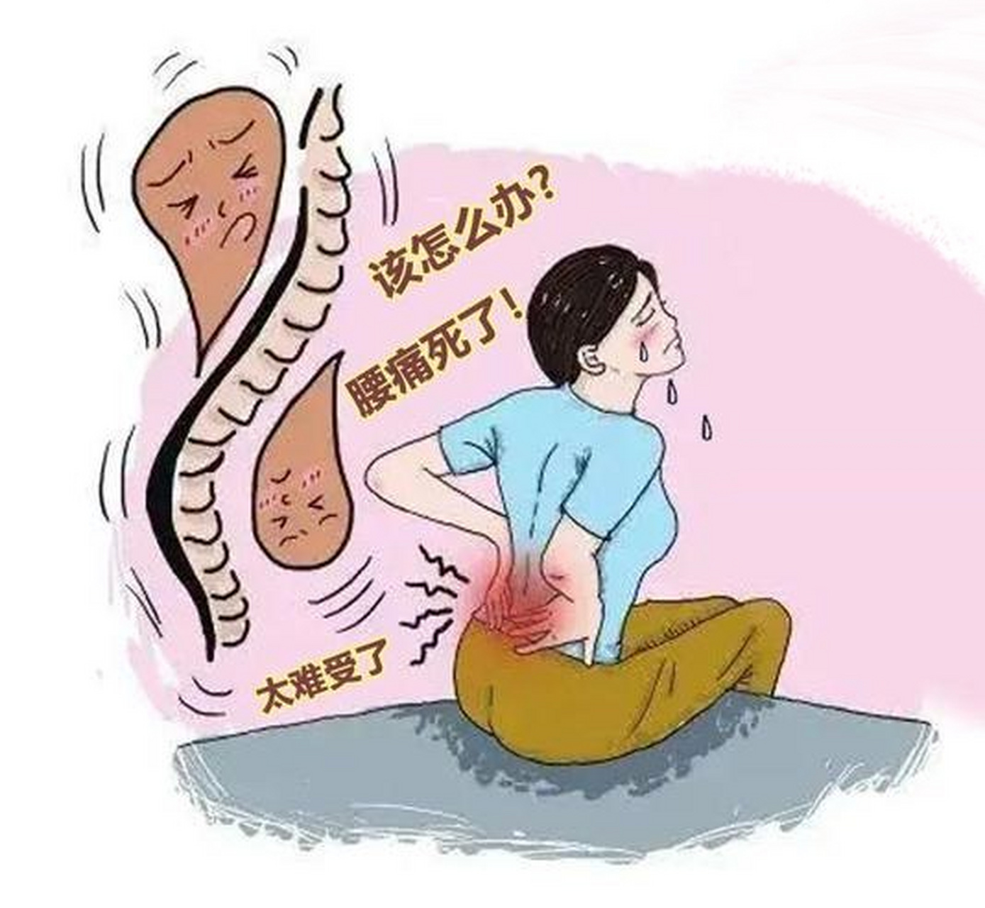四种腰疼类型,可能伴有严重疾病,请及时就医 腰疼不是小事,大家要注意
