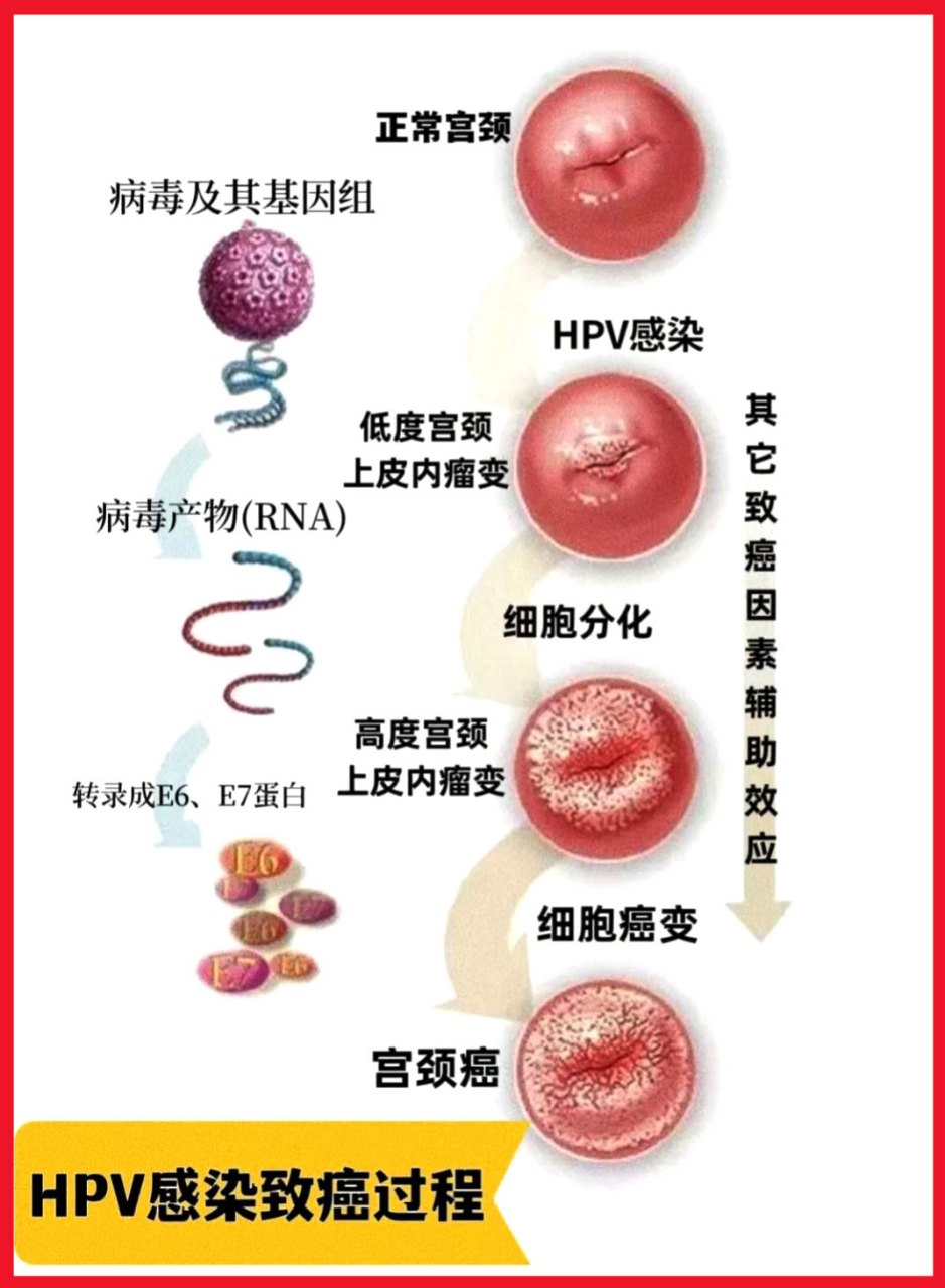 hpv病毒女性症状图片