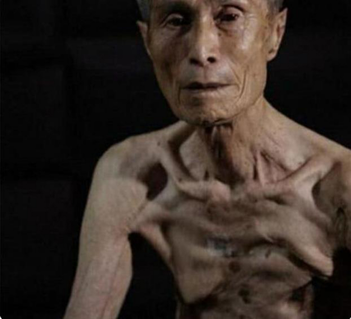 谷口晔是长崎核爆的幸存者,经过医院三年的艰苦抢救,勉强保住了性命.