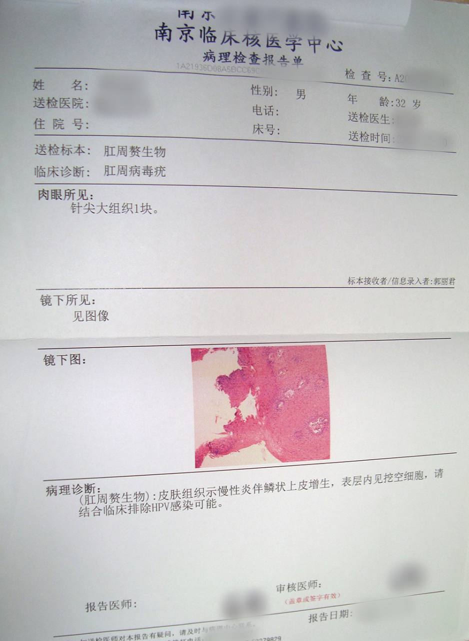 患者【男,32岁】半个月前发现肛门周围长了一些颗粒,摸着软软的,没啥