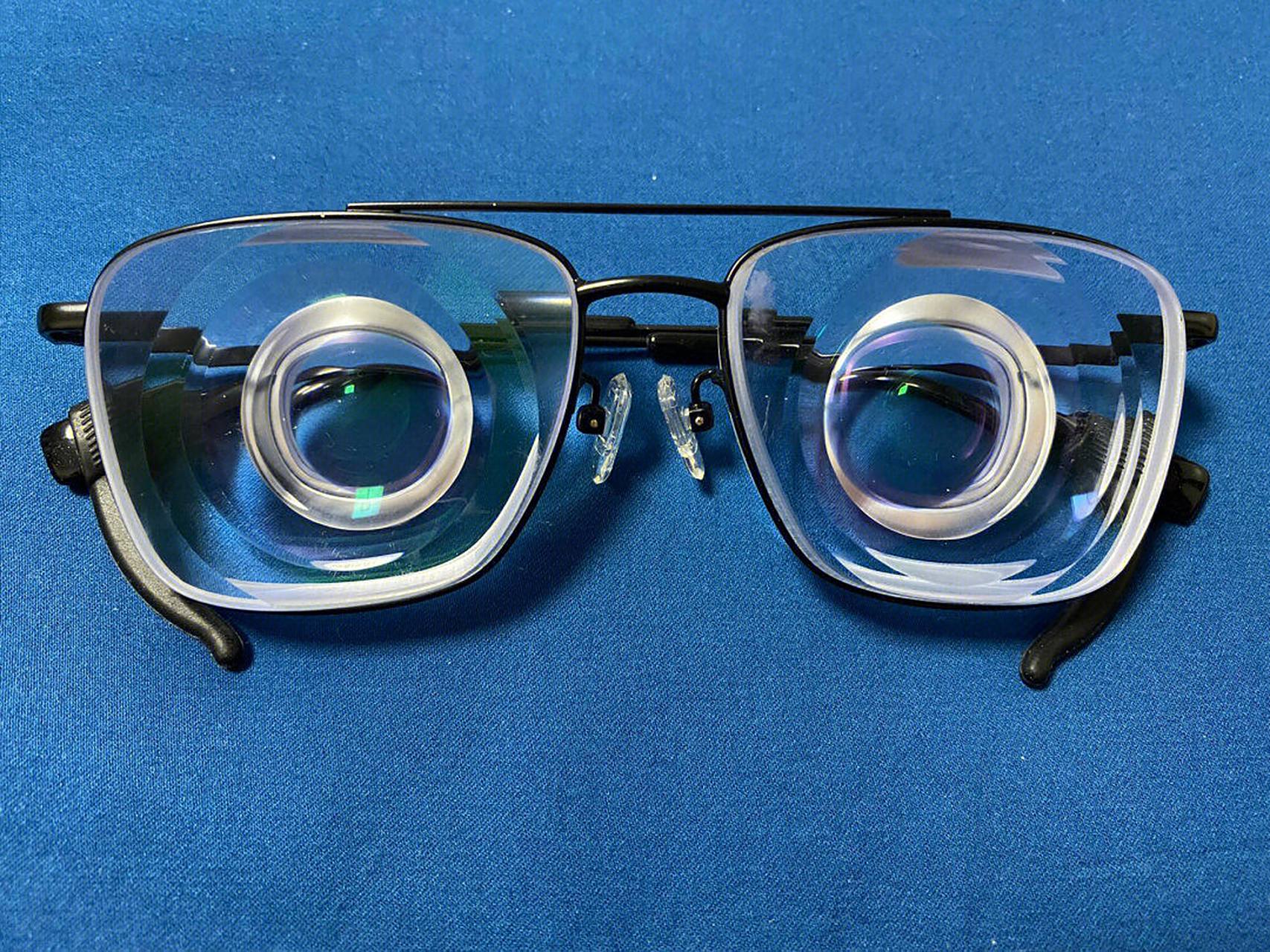 怪不得总是听人说,高度近视眼镜是酒瓶底,还真是.猜猜这是多少度?