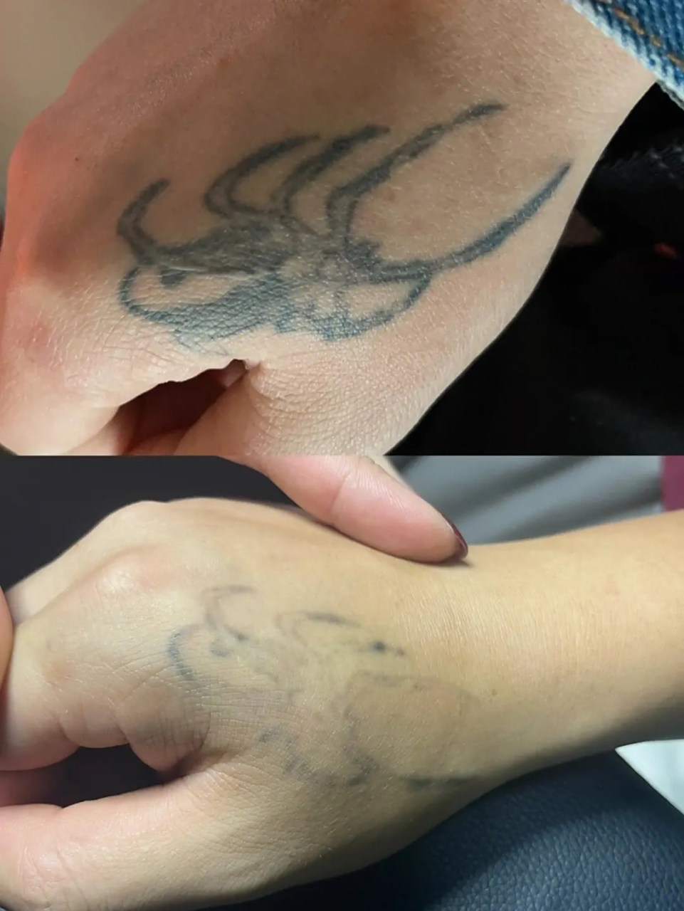 洗纹身方法有:激光去纹身,化学洗纹身,手术切除等.