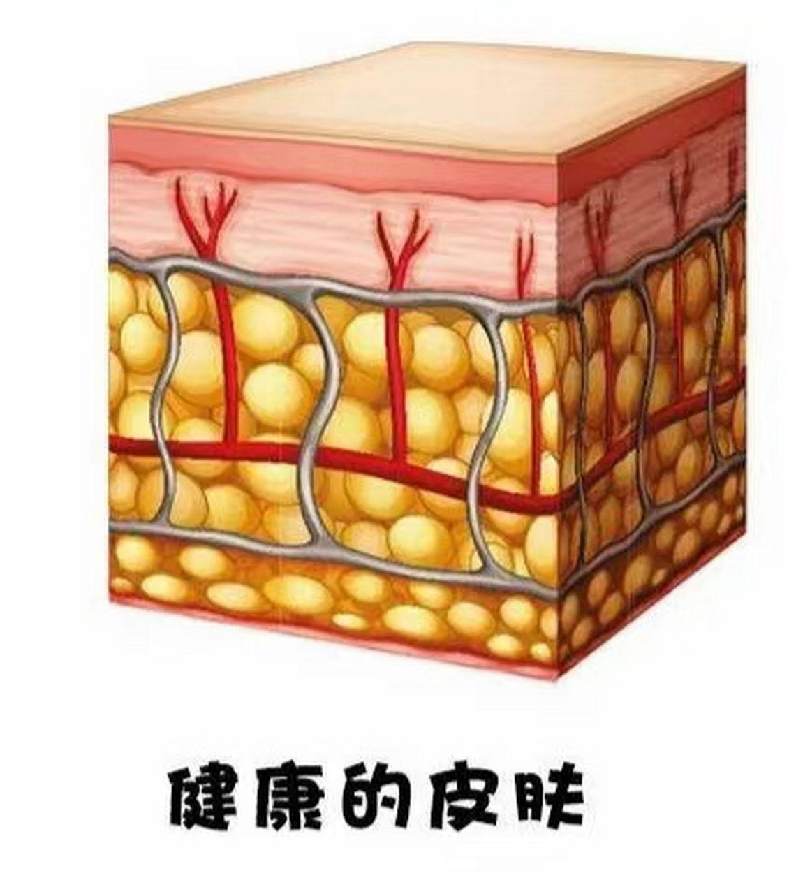 私信有求美者问起大腿后侧有坑坑洼洼的橘皮,吸脂能不能让它改变或者