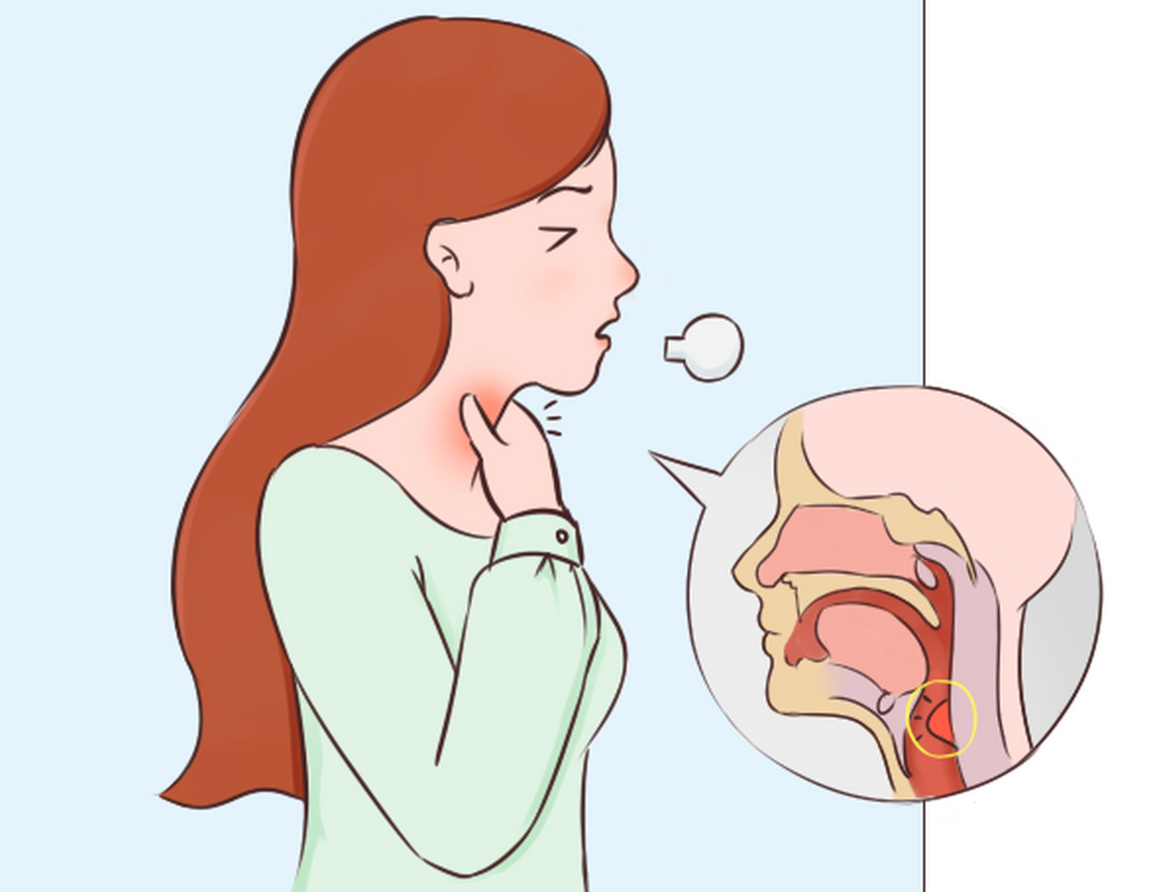 得了慢性咽炎能完全治好吗?