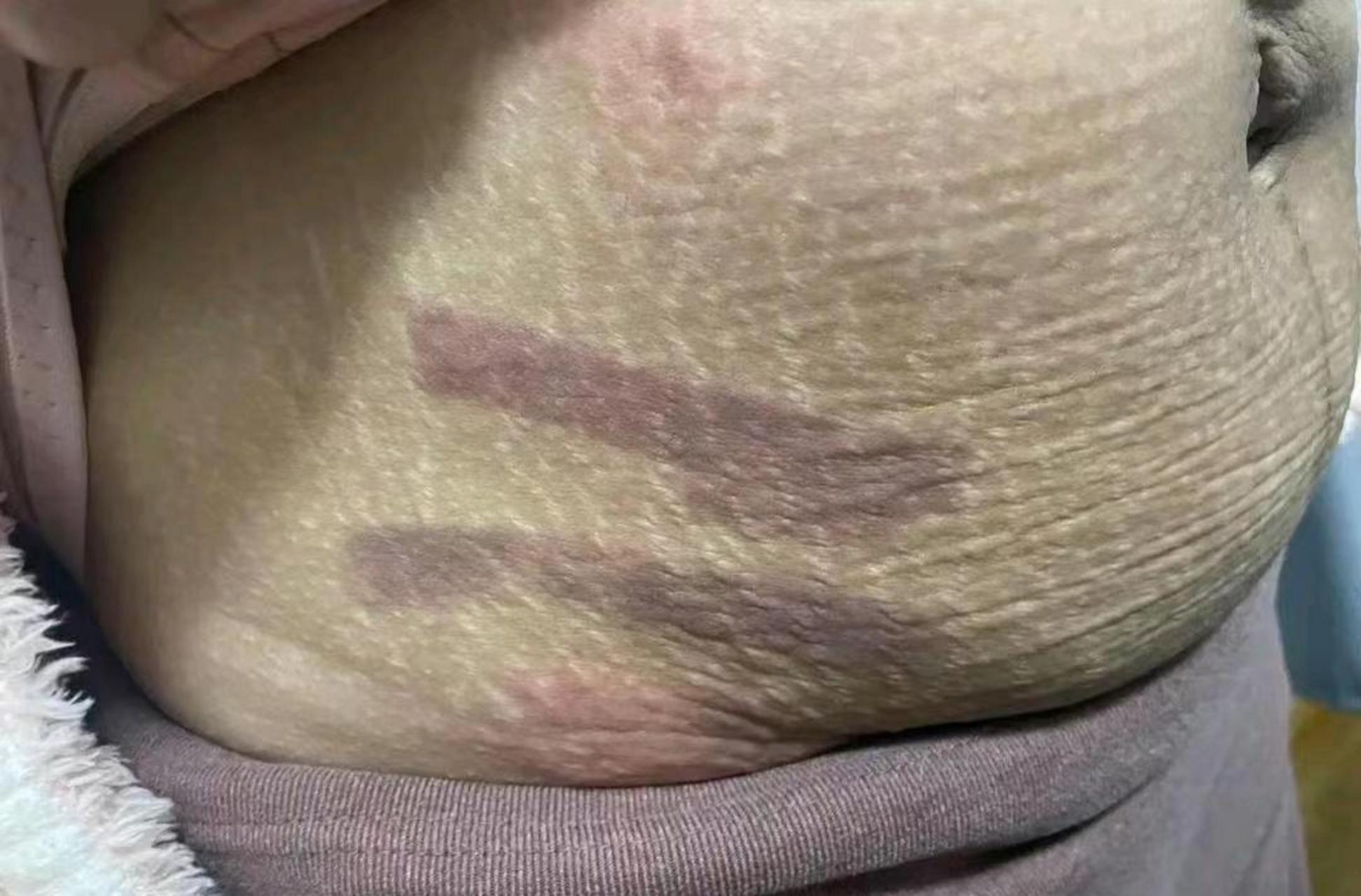 网友:我媳妇生完孩子,肚子就成这样了,怎么办啊