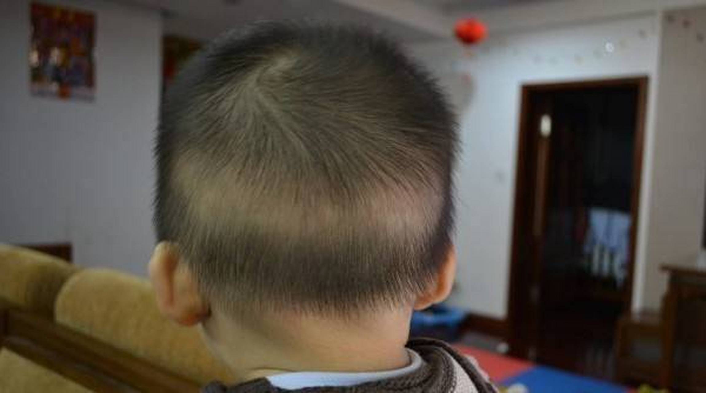 轻松育儿30s问答#  问:宝宝枕秃是缺钙吗?