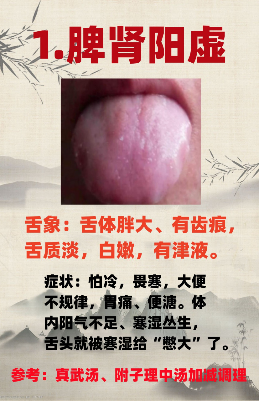 齿痕舌常见的两种证型 通过舌头看你是脾胃阳虚还是脾胃湿热导致的