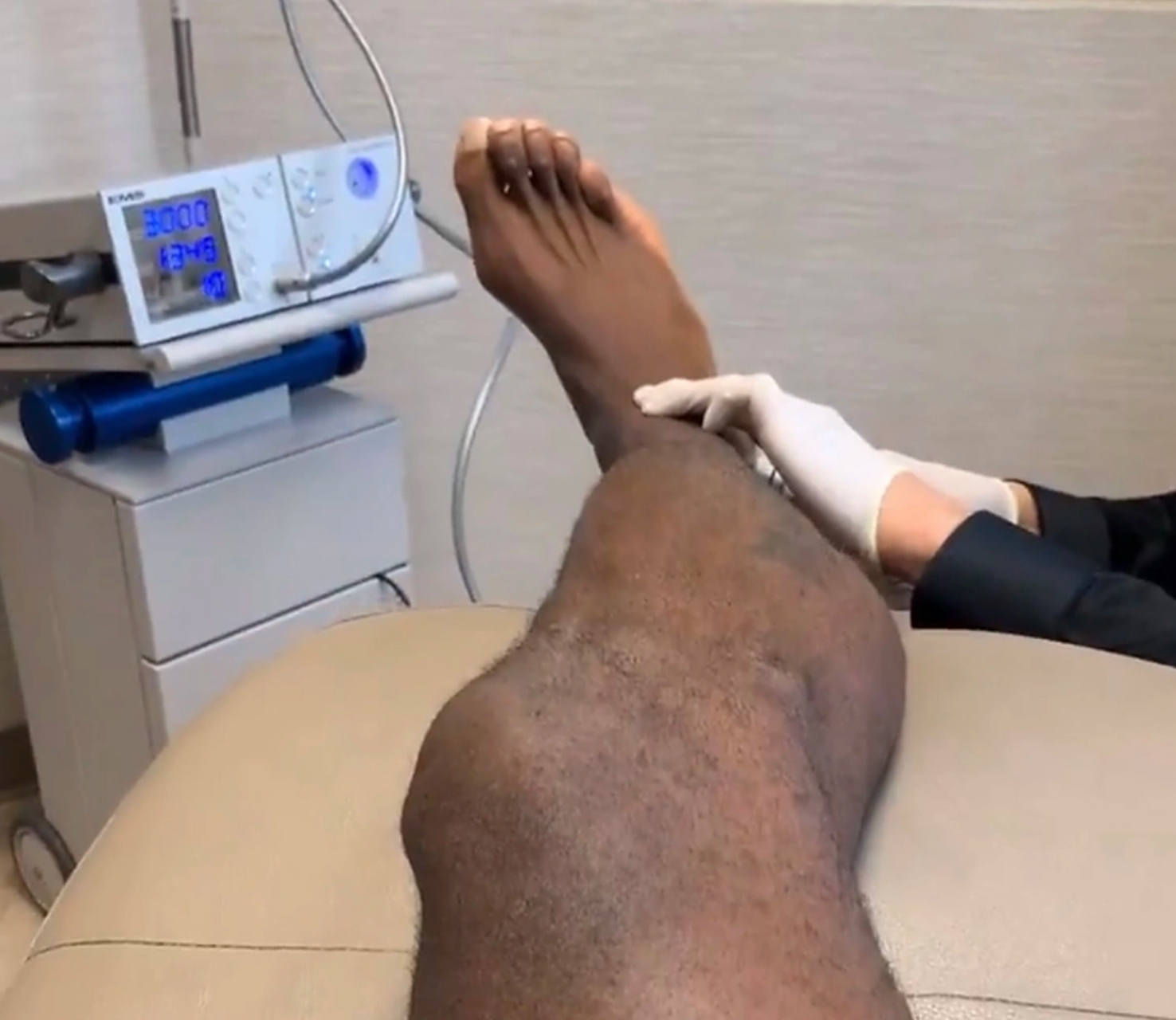 医师:詹姆斯跟腱进行冲击波理疗,不必担心 今日,湖人前锋勒布朗