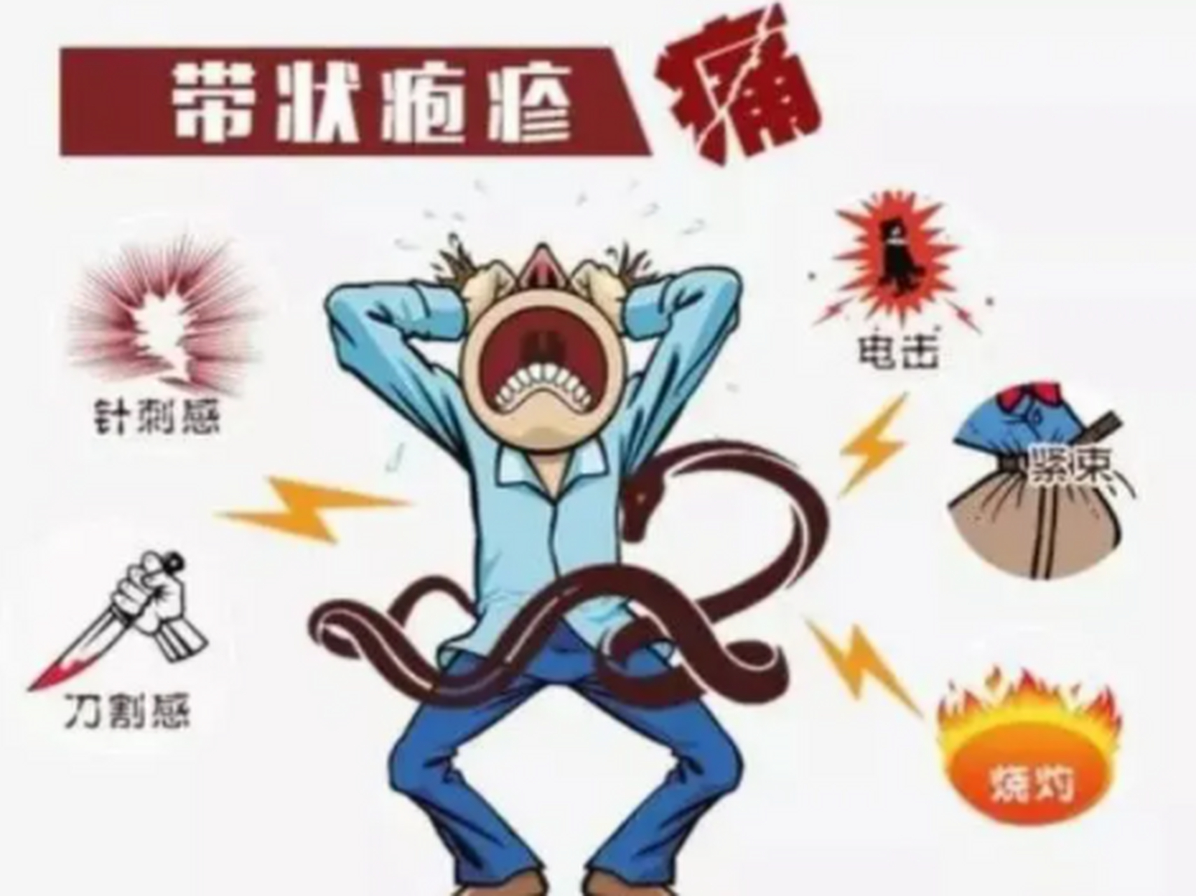 带状疱疹# 又称缠腰龙,是由水痘-带状疱疹病毒感染引起的一种疾病.