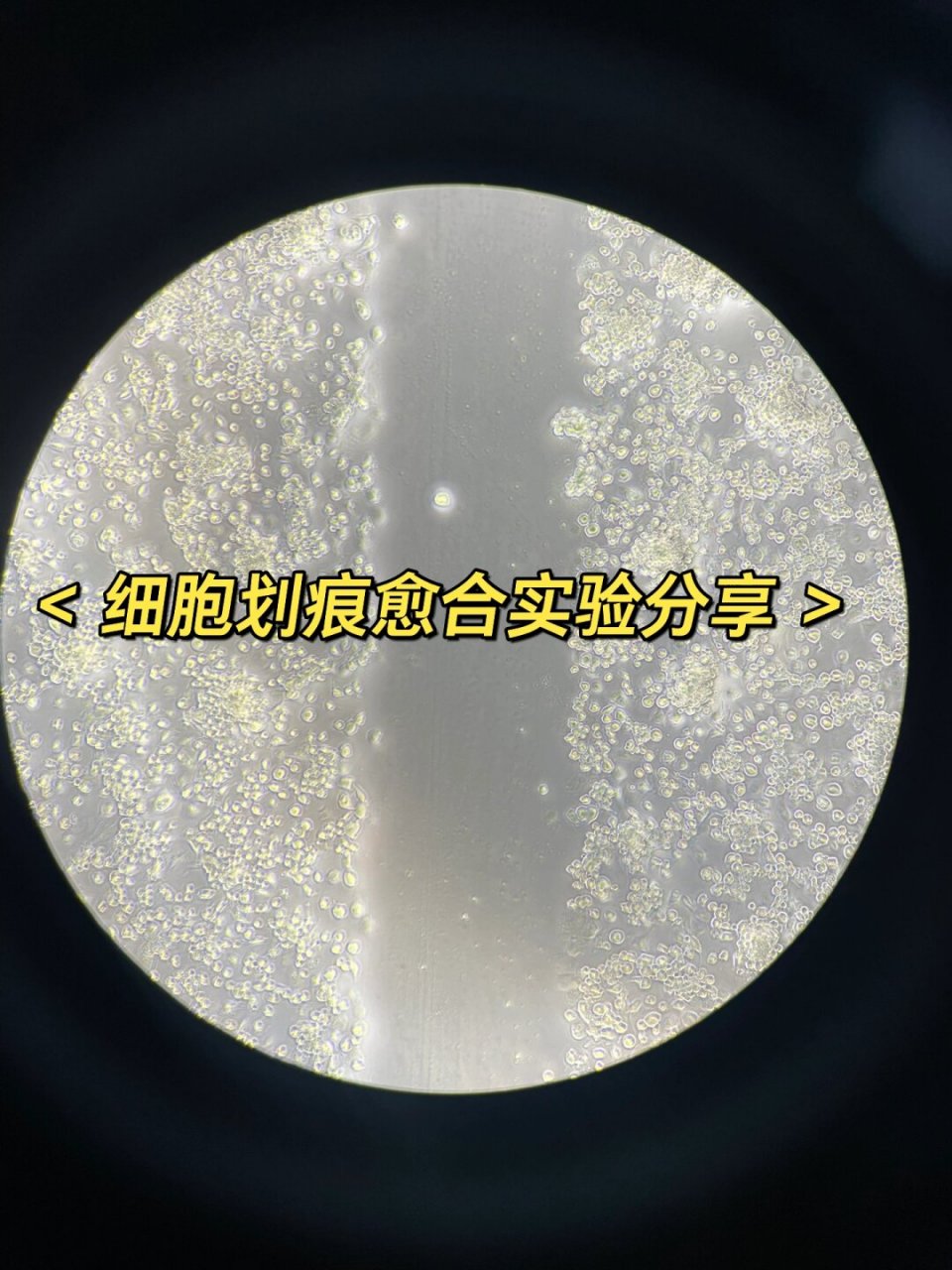 细胞划痕实验分享