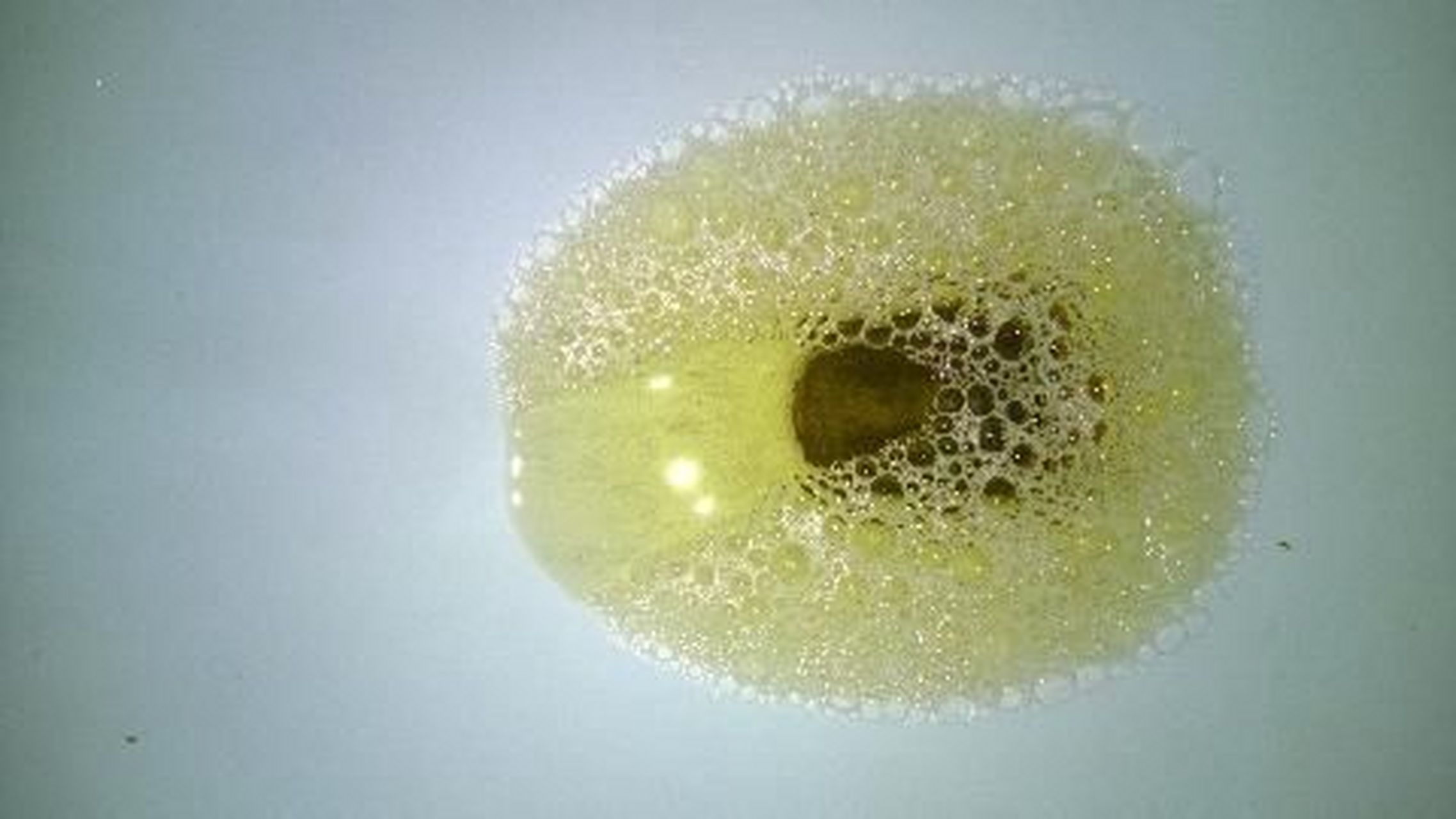 尿液产生泡沫的原因主要是尿液中出现了一些有机物质和无机物质使 