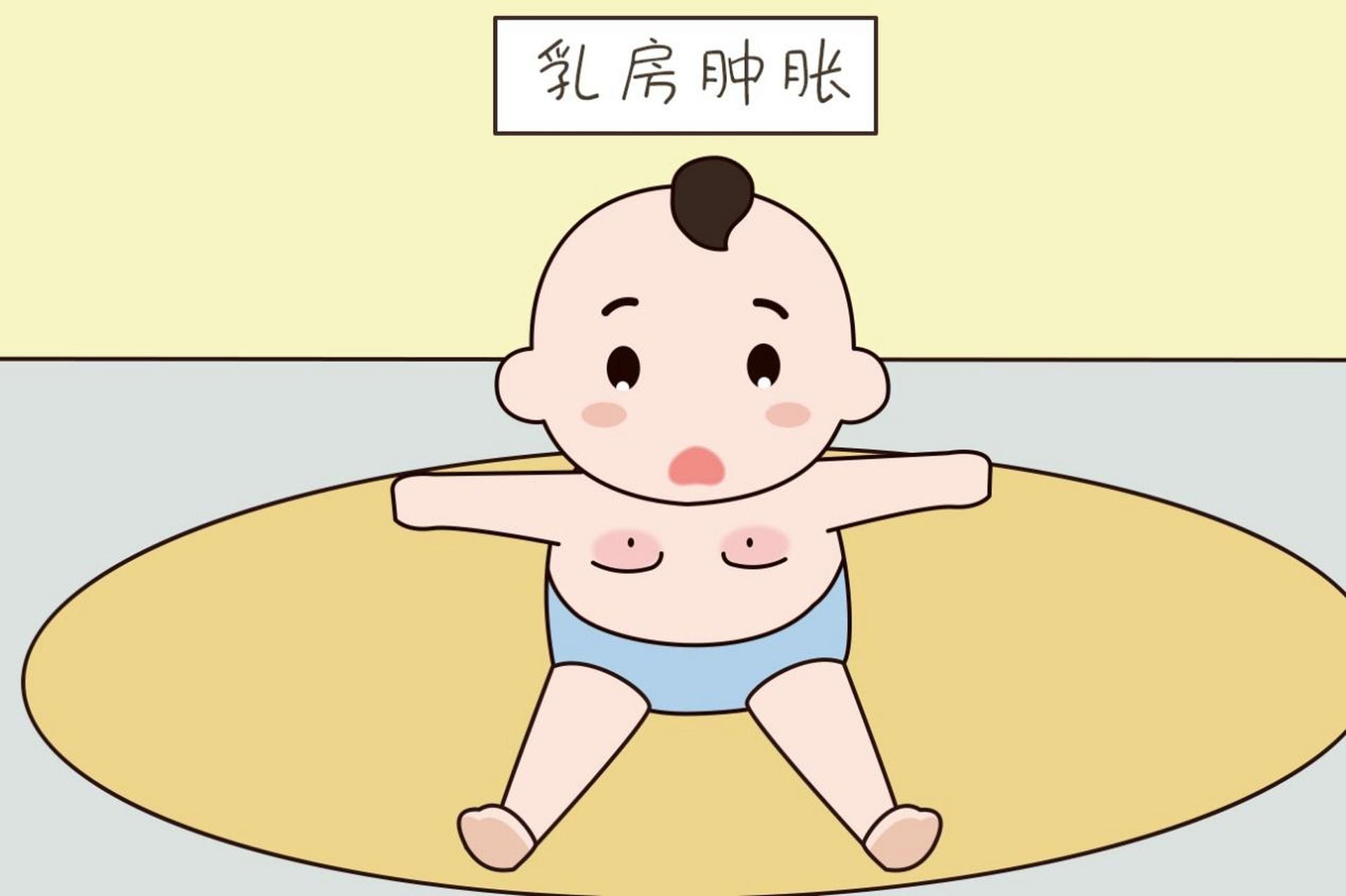 新生儿乳腺肿大图片