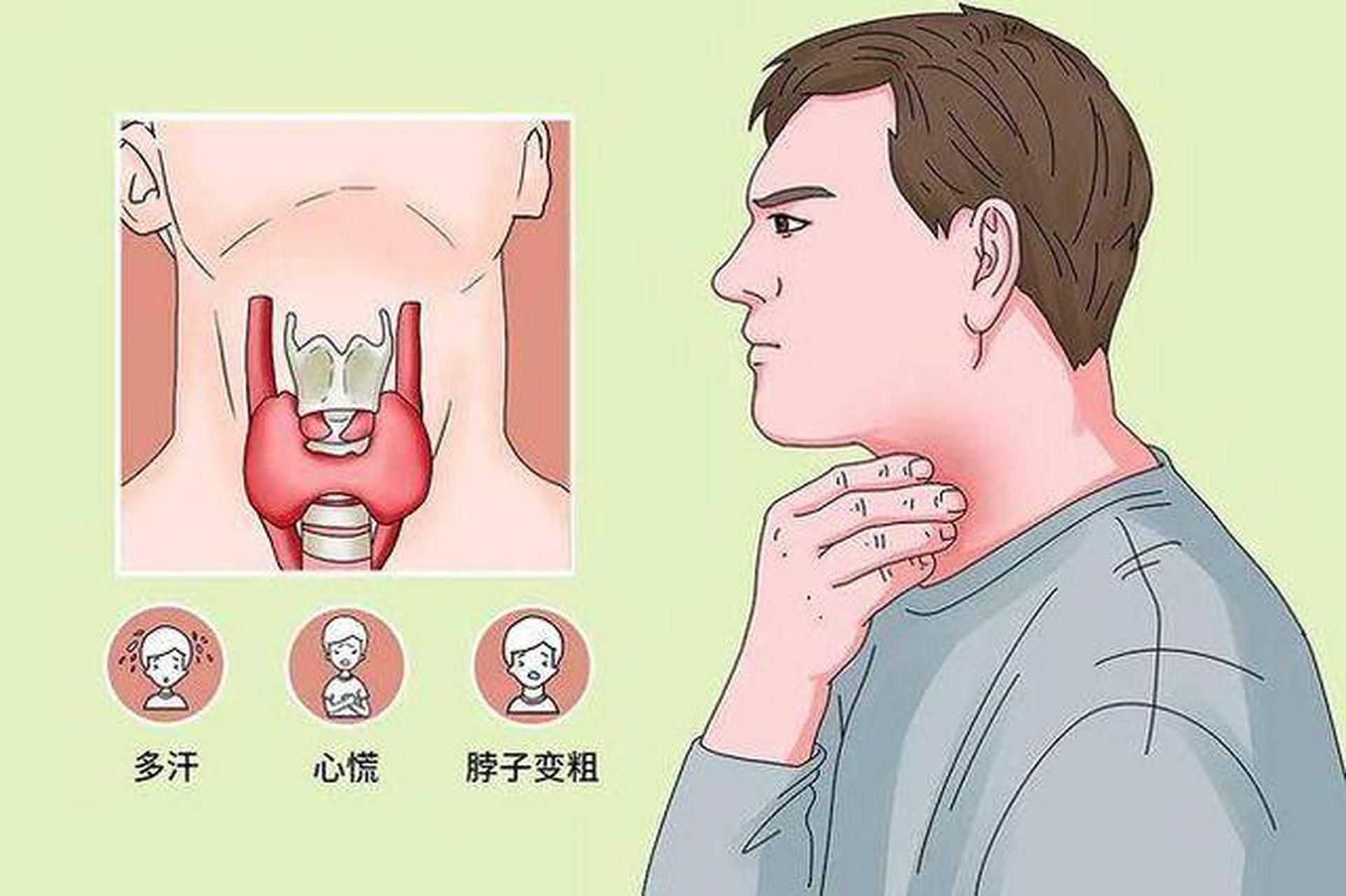 促甲状腺激素偏高图片