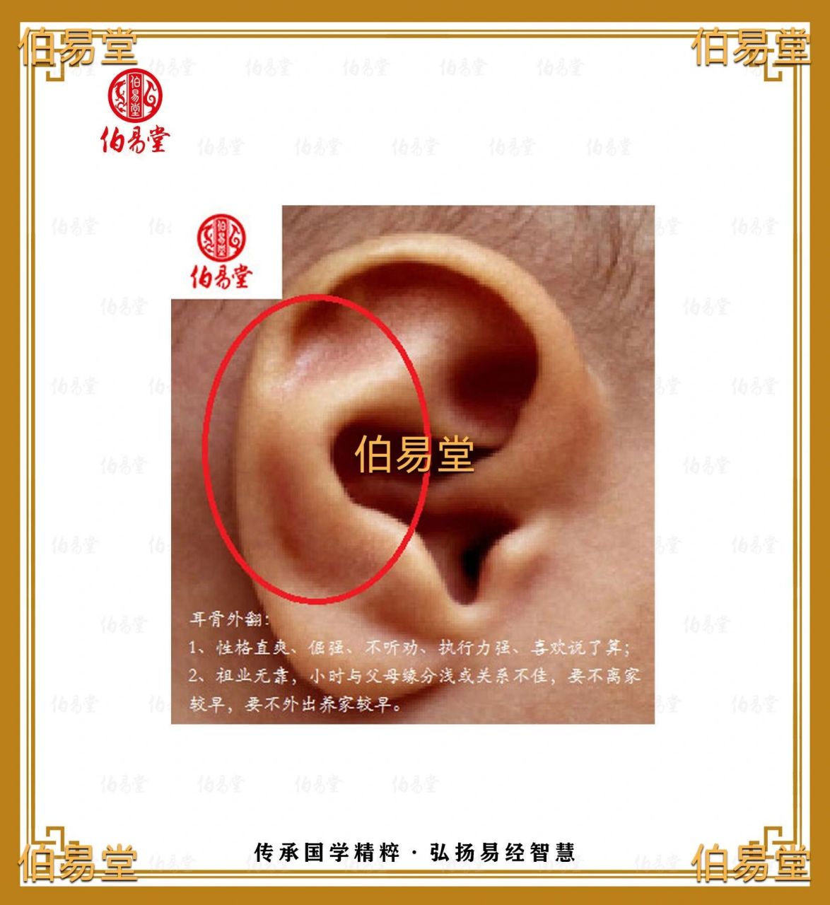 耳廓外翻代表什么图片